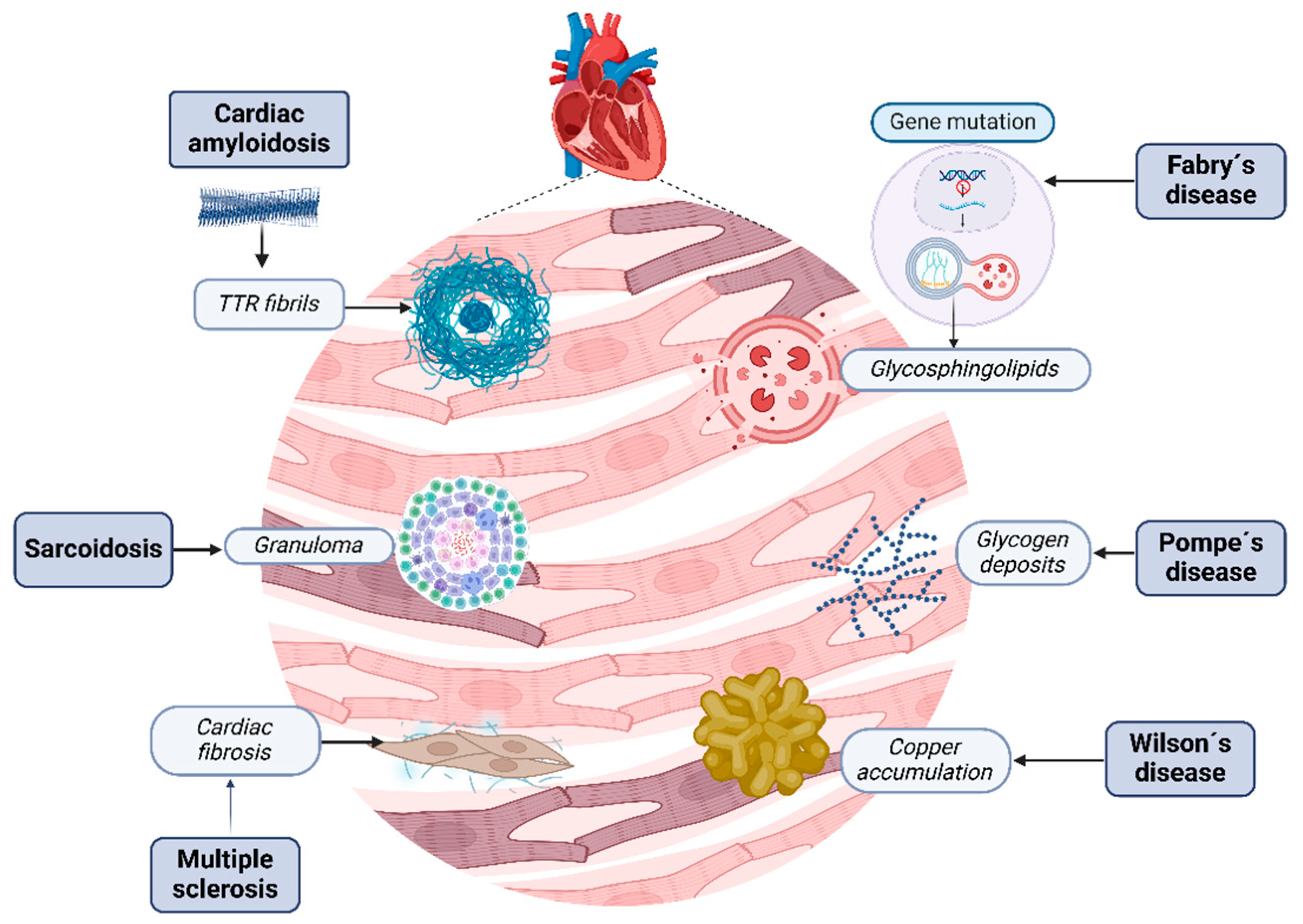 Gut-Heart Axis: Microbiome Involvement in Restrictive