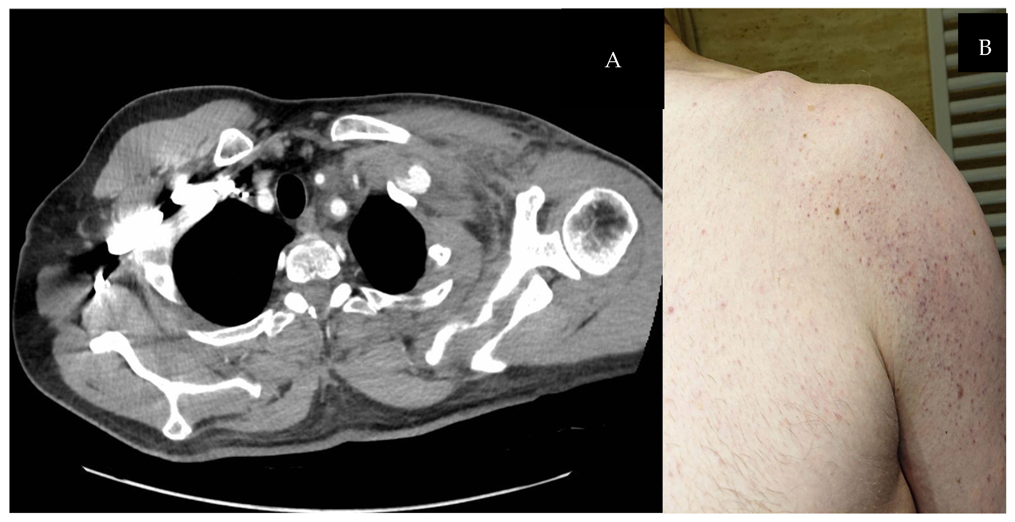 Biomedicines 13 00187 g001 Biomedicines 13 00187 g001