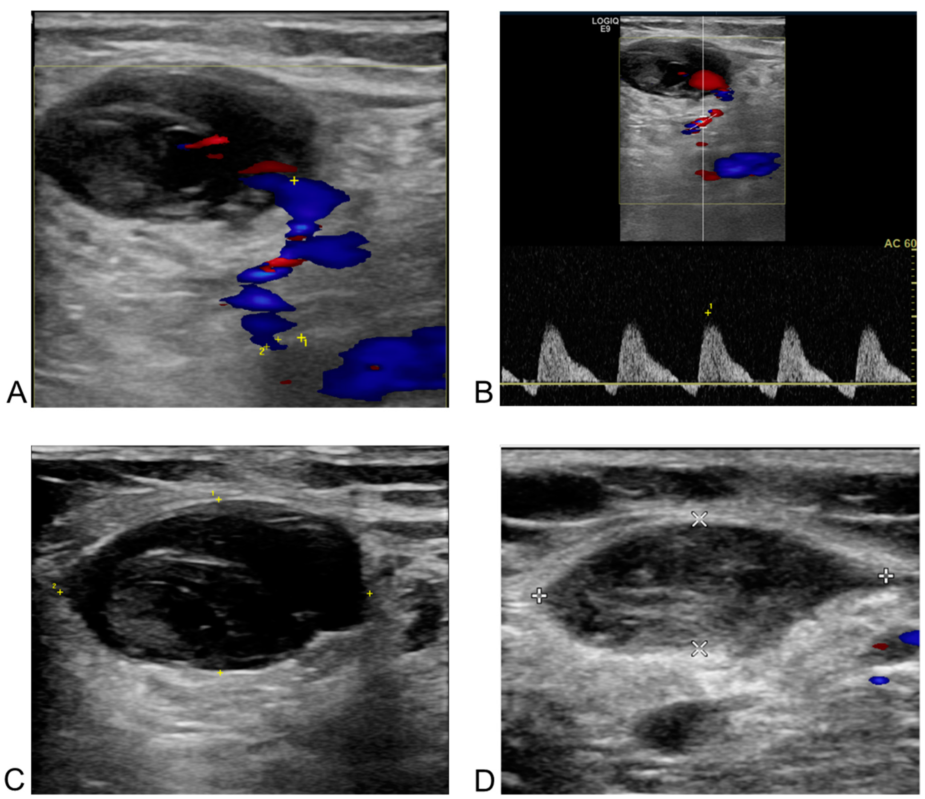 Biomedicines 13 00314 g005