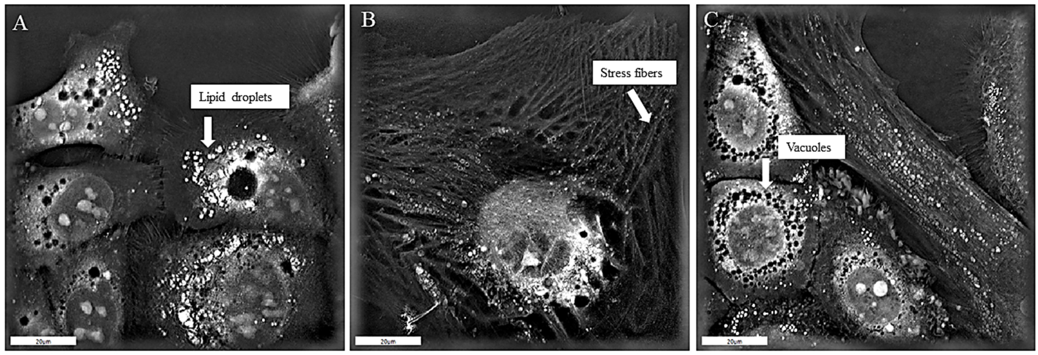 Biomedicines 13 00358 g003 Biomedicines 13 00358 g003