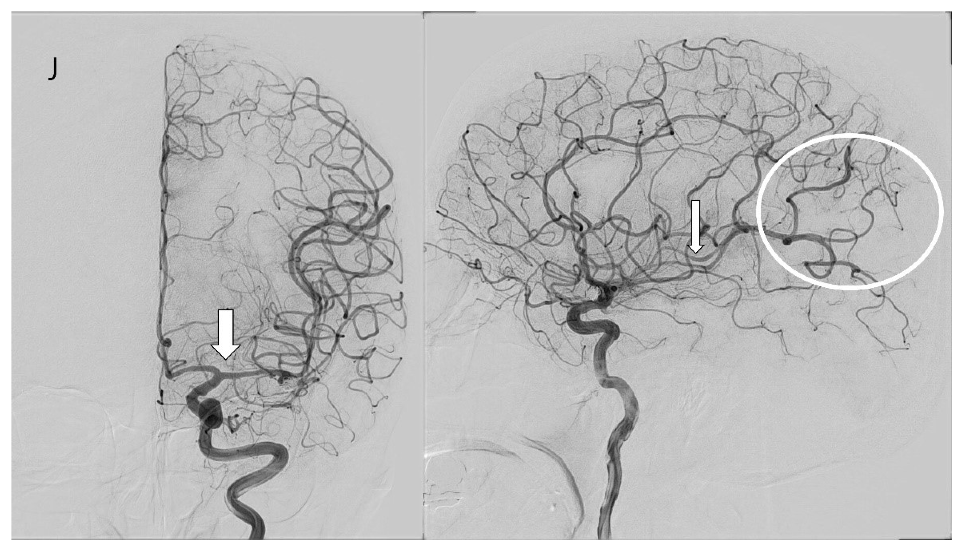 Biomedicines 13 00442 g003d
