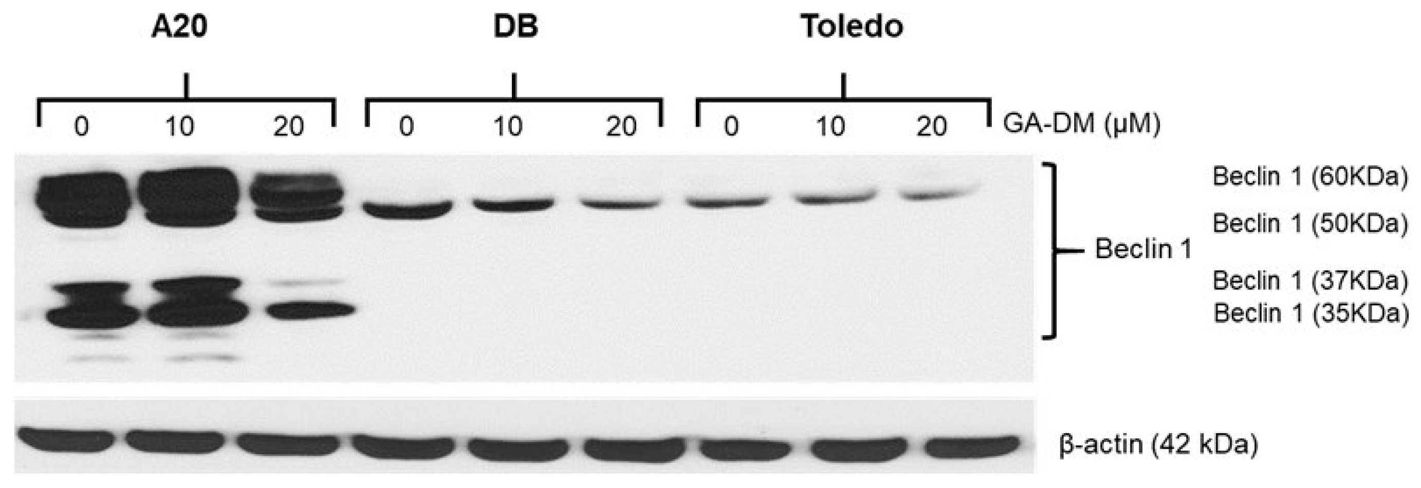 Biomedicines 13 00445 g004