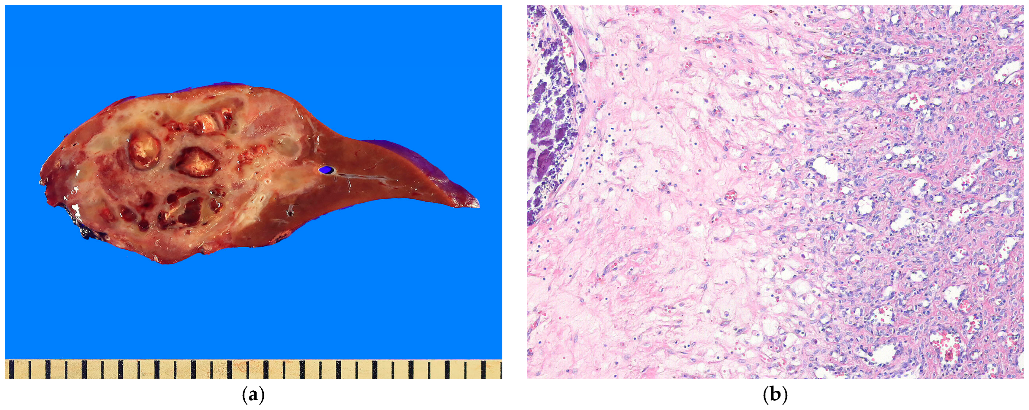 Biomedicines 13 00479 g001