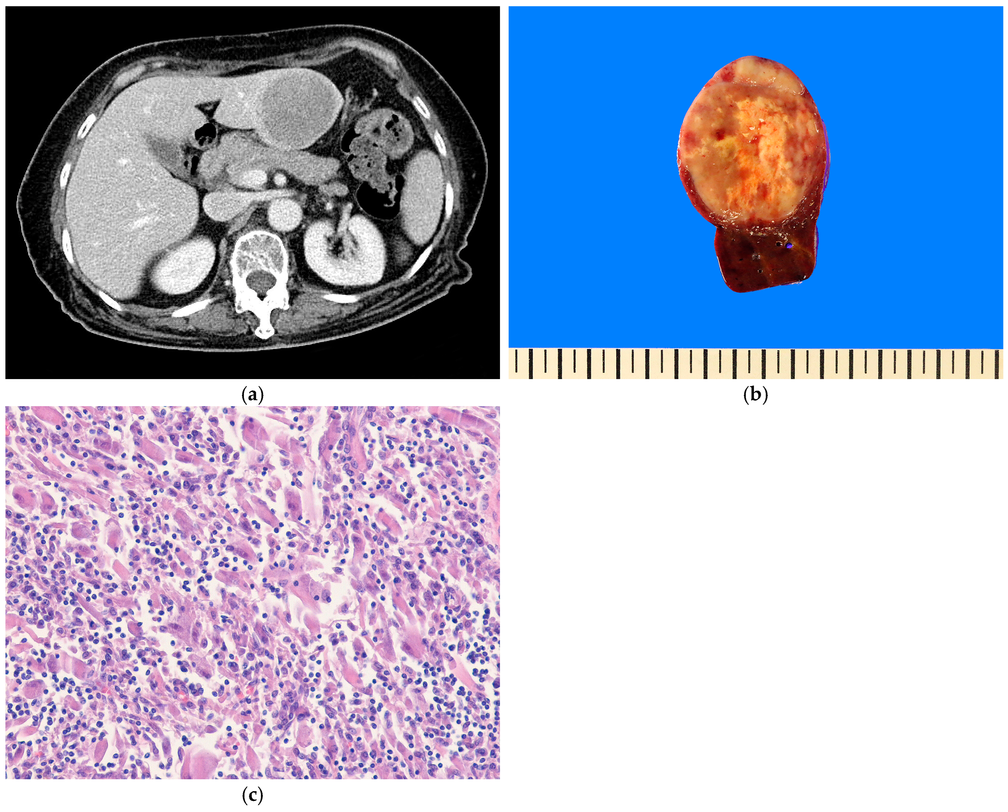 Biomedicines 13 00479 g008
