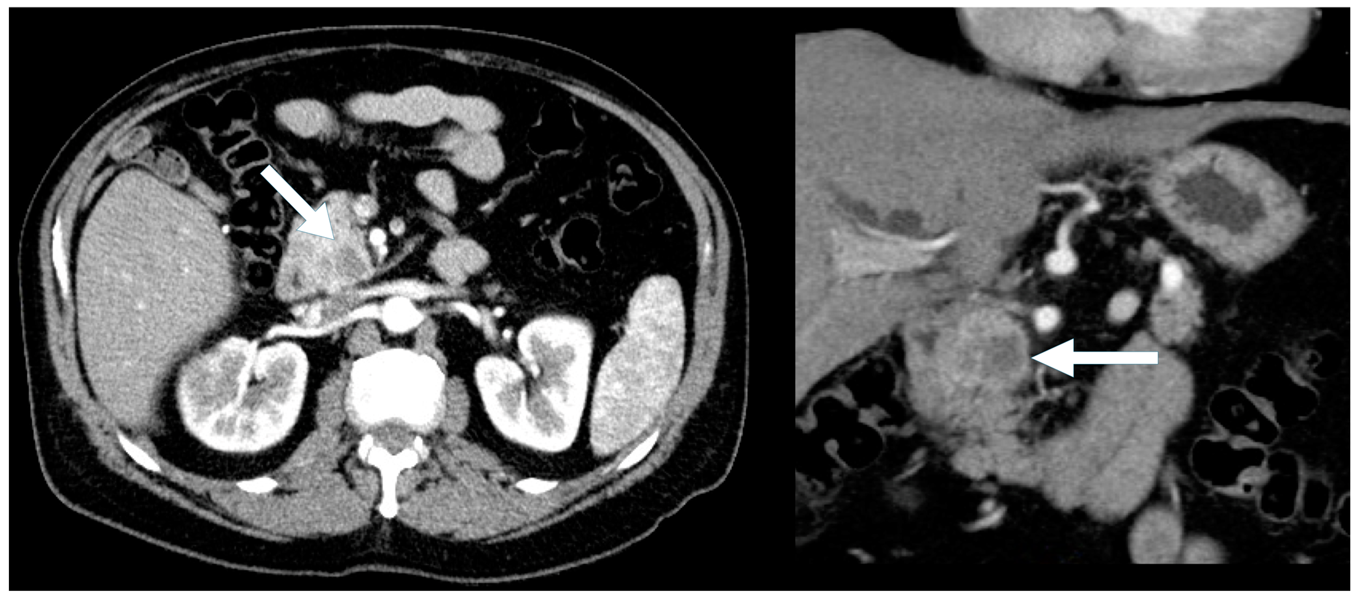 Biomedicines 13 00496 g004