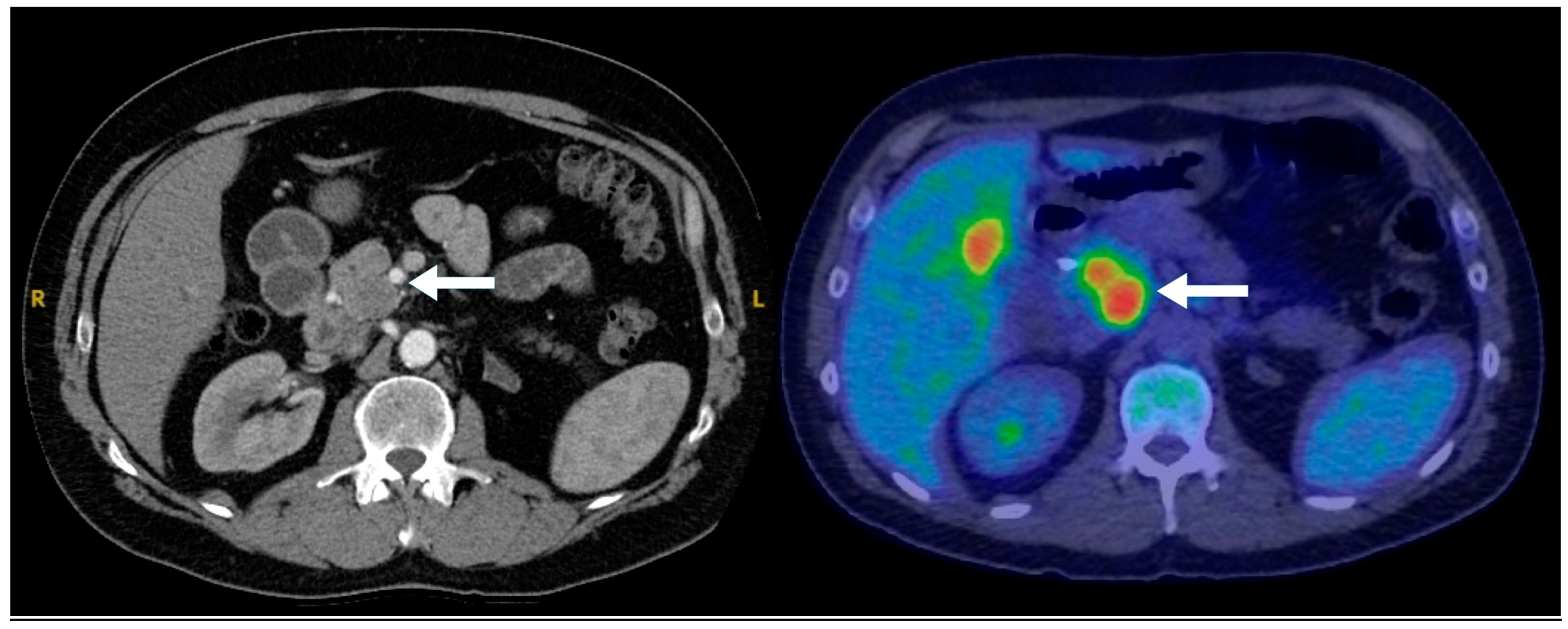 Biomedicines 13 00496 g006