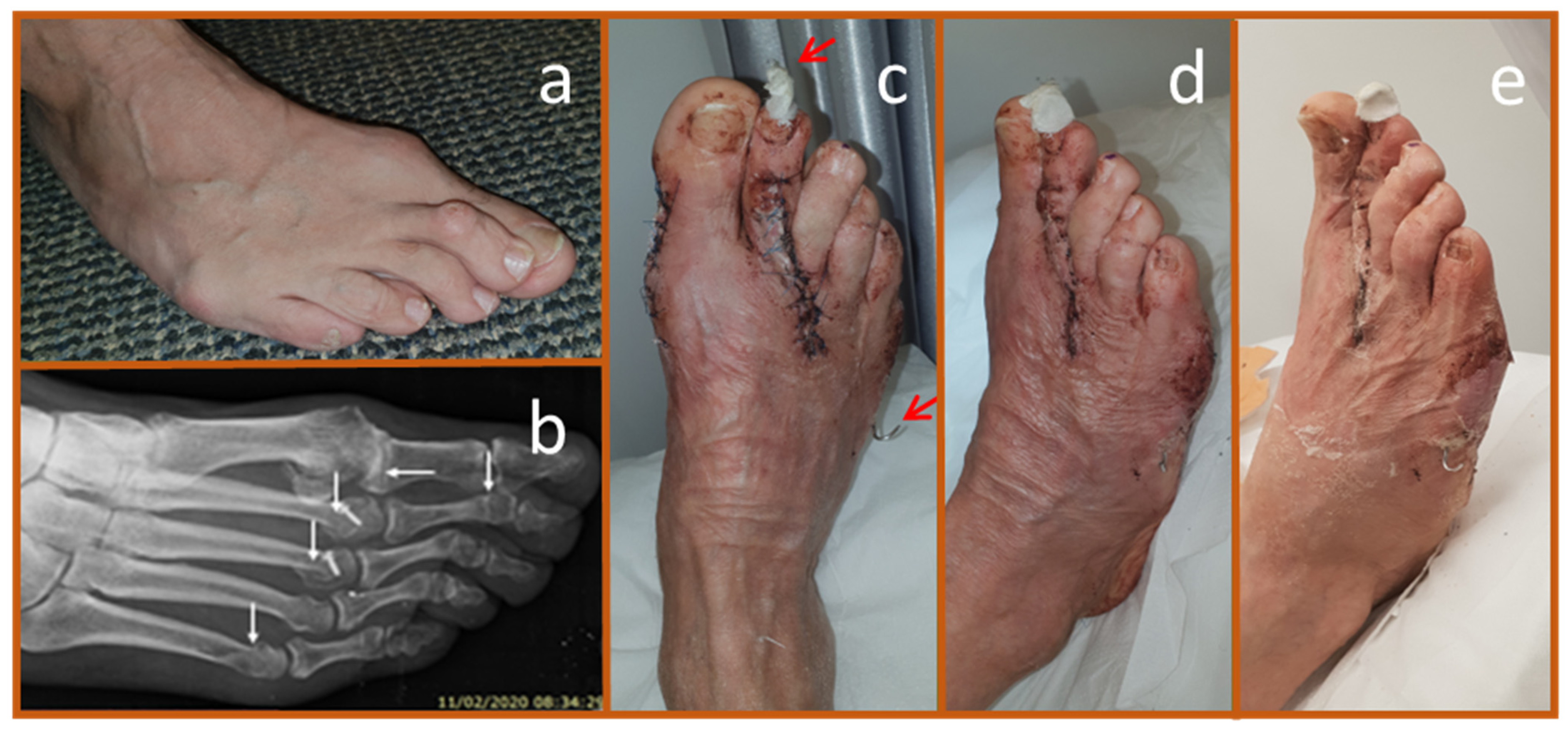 Biomedicines 13 00562 g005