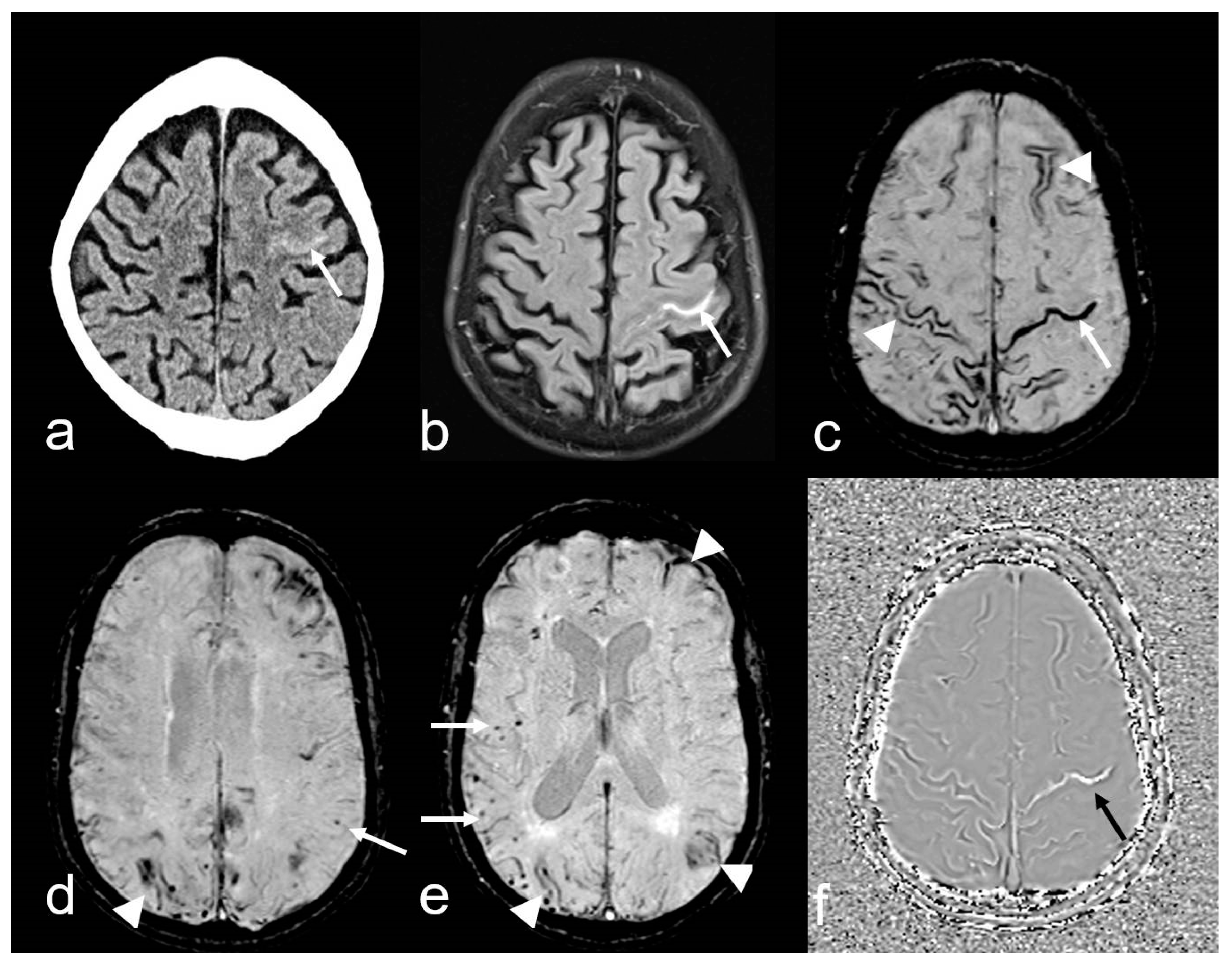 Biomedicines 13 00603 g004