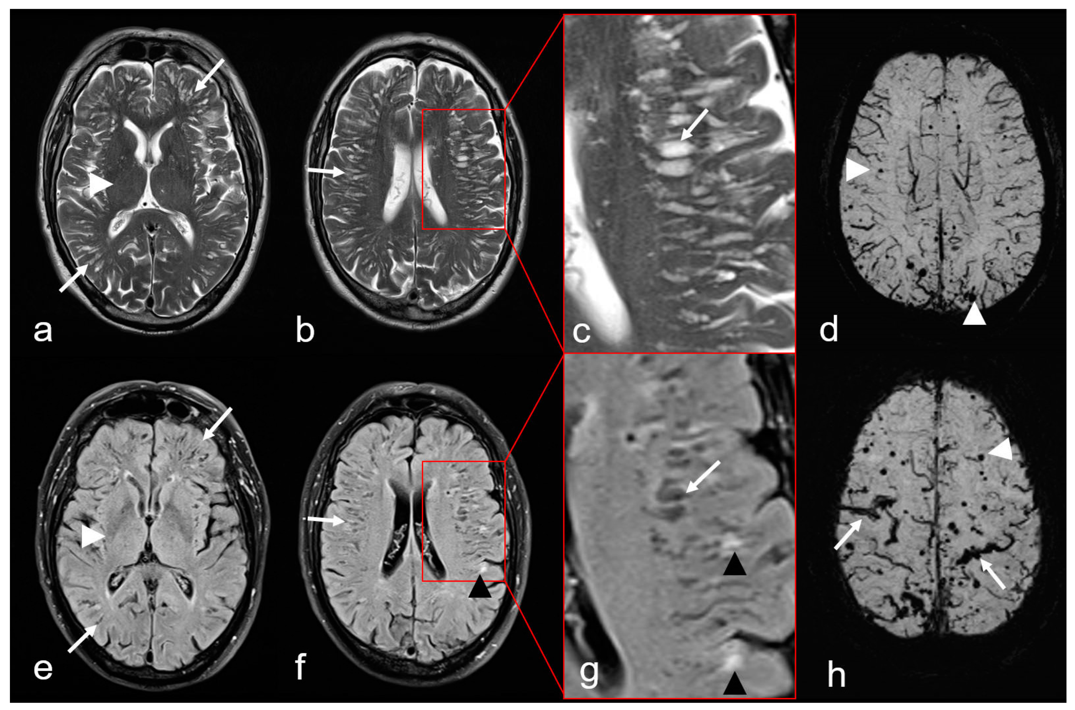 Biomedicines 13 00603 g005