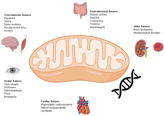 Leigh Syndrome: A Comprehensive Review of the Disease and
