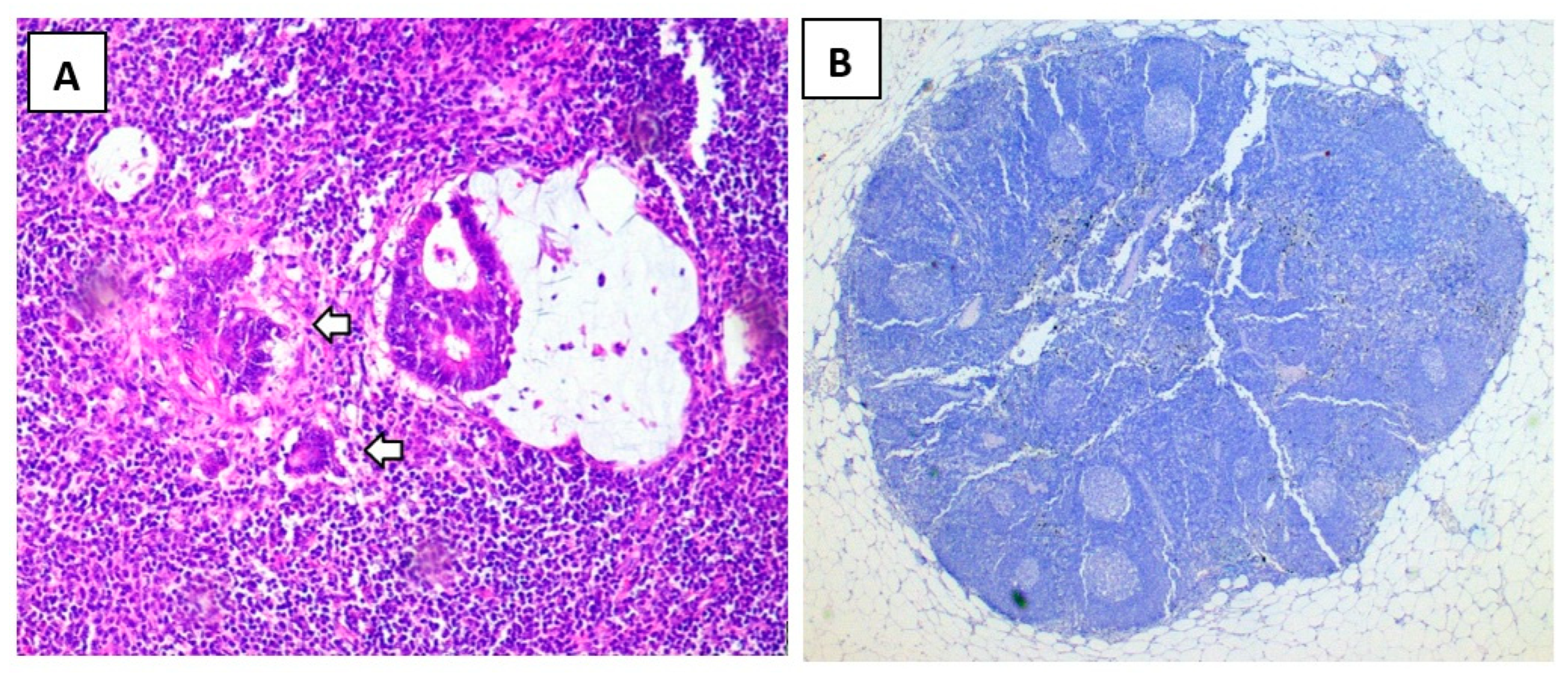 Biomedicines 13 00902 g004