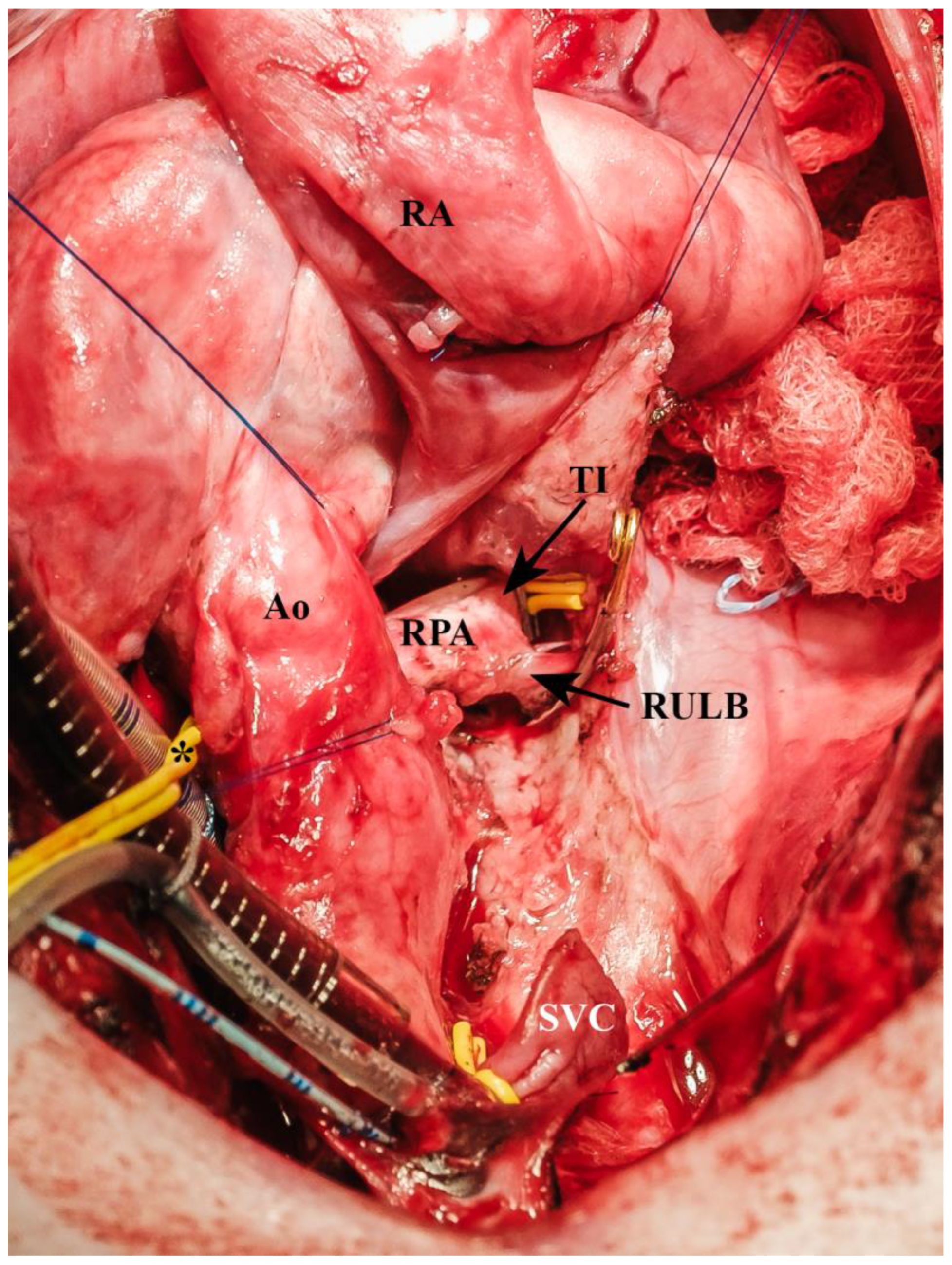 Biomedicines 13 00918 g004 Biomedicines 13 00918 g004