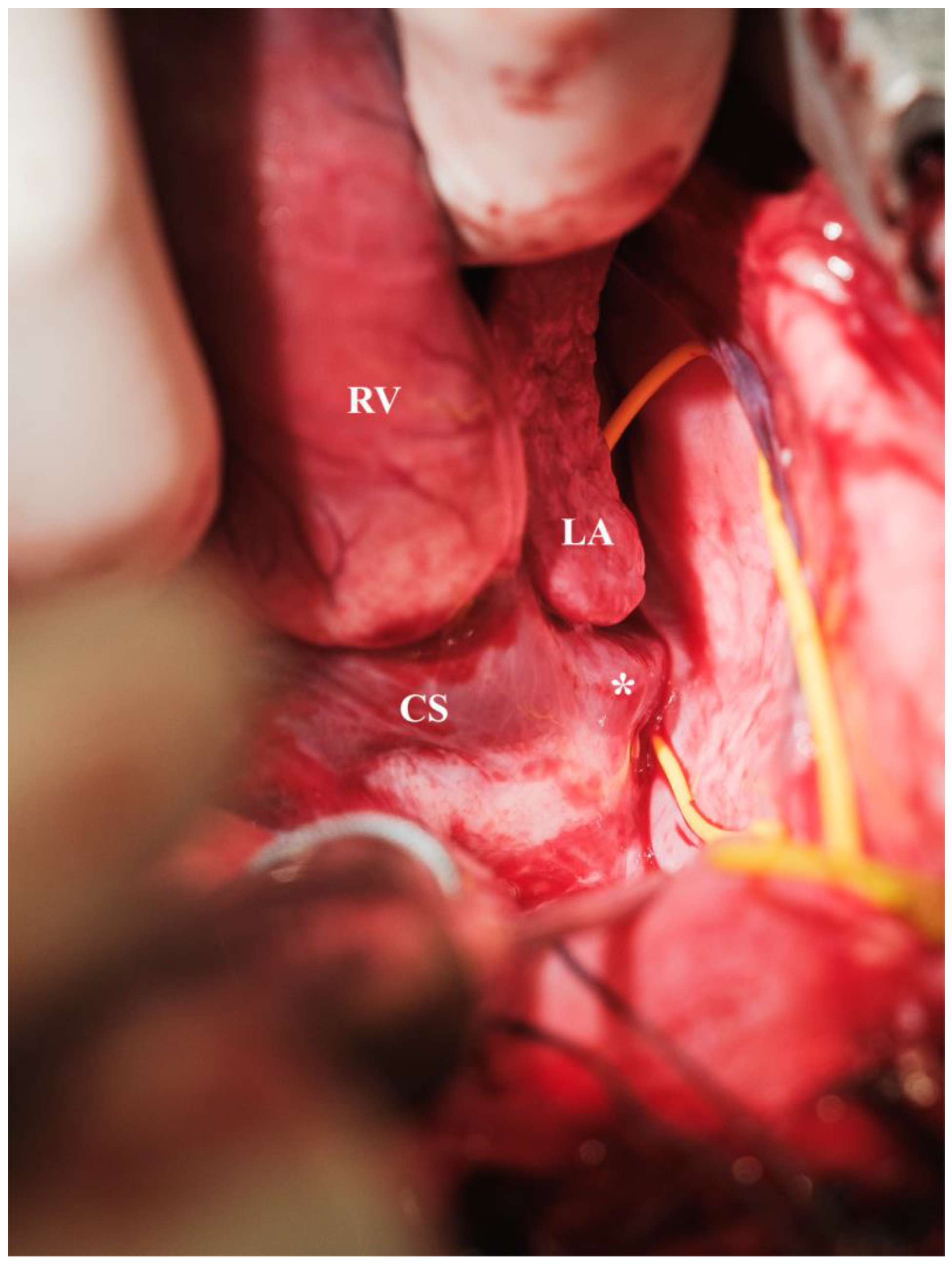 Biomedicines 13 00918 g005 Biomedicines 13 00918 g005