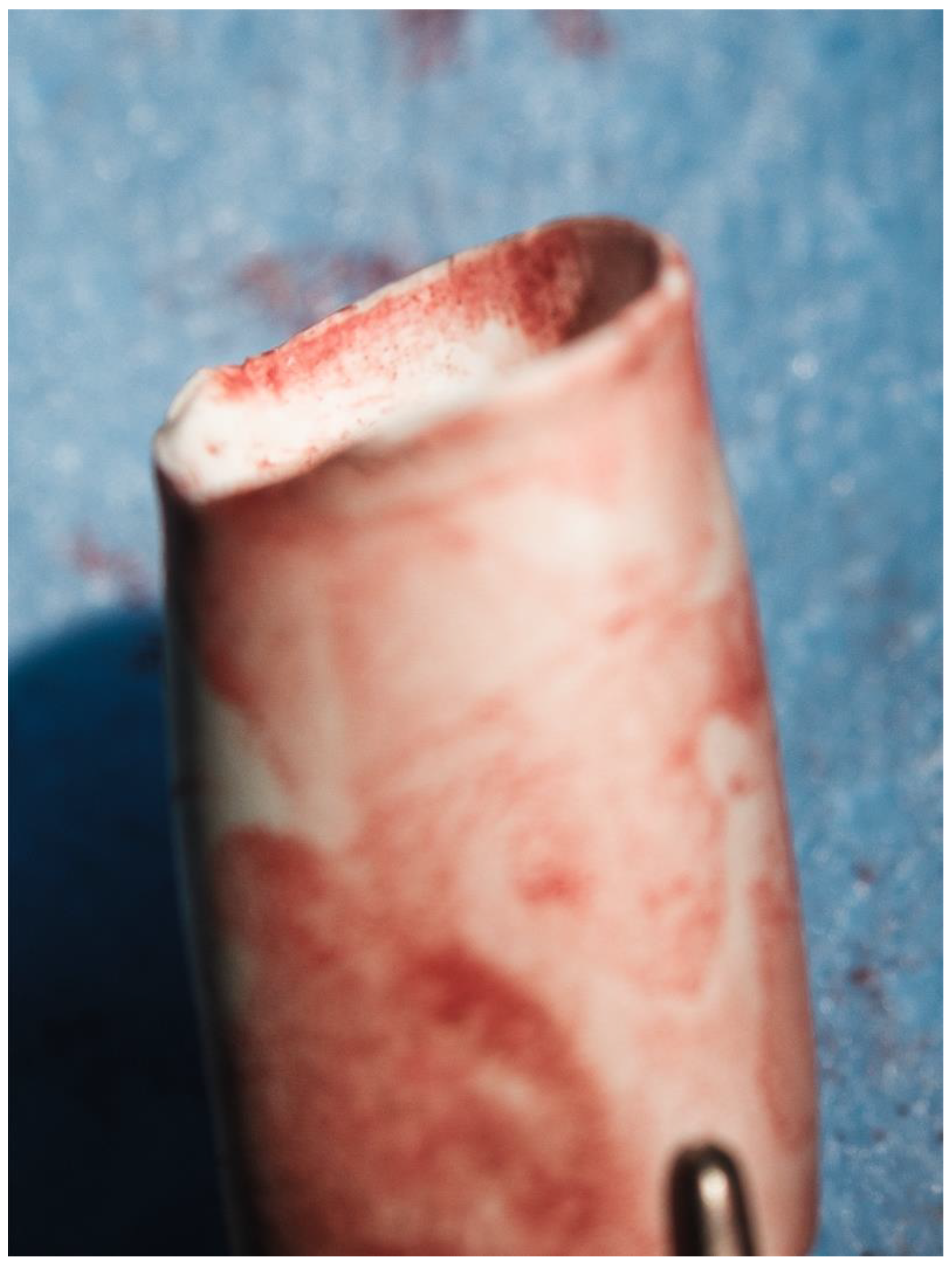 Biomedicines 13 00918 g007 Biomedicines 13 00918 g007