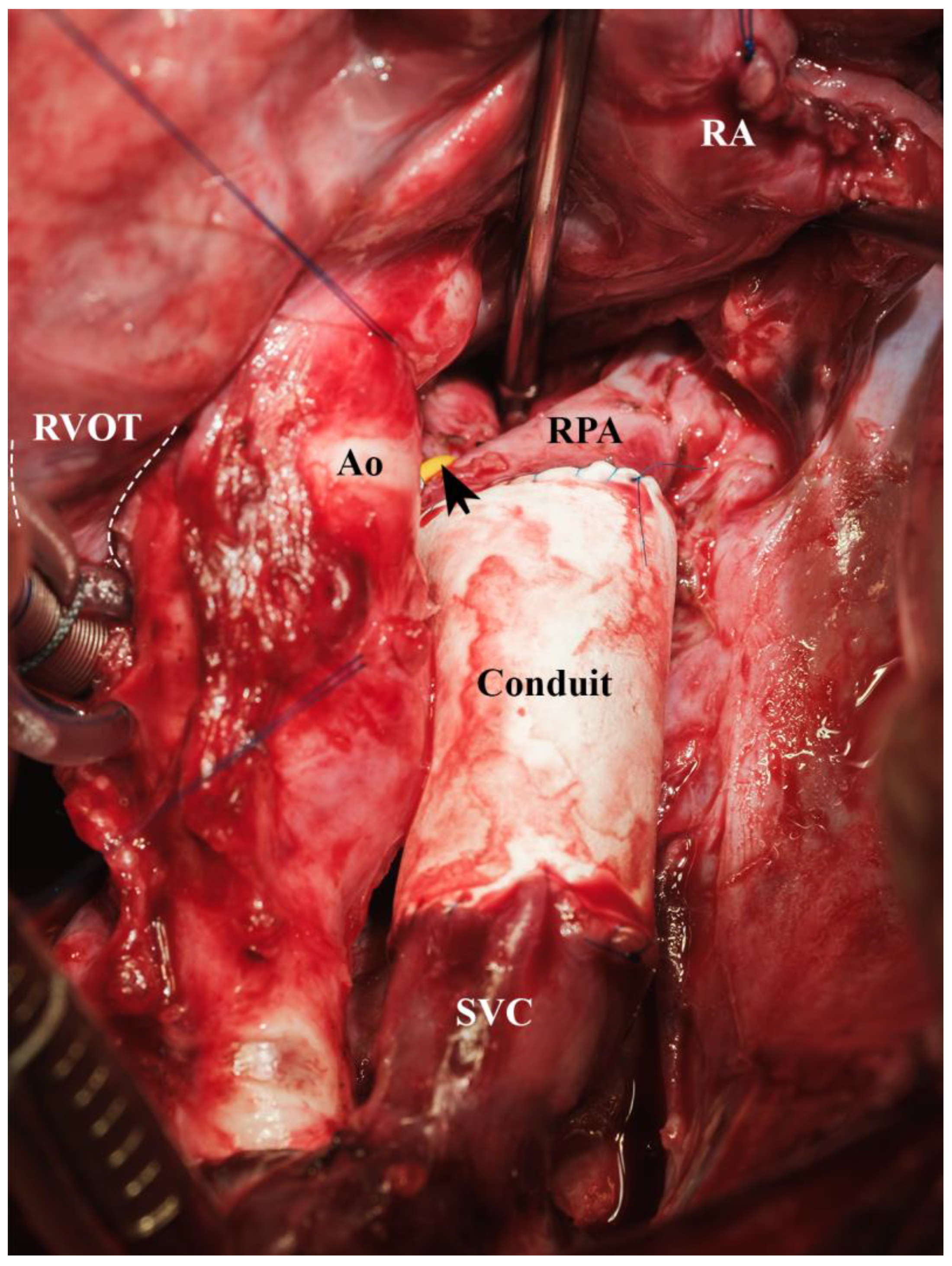 Biomedicines 13 00918 g012 Biomedicines 13 00918 g012