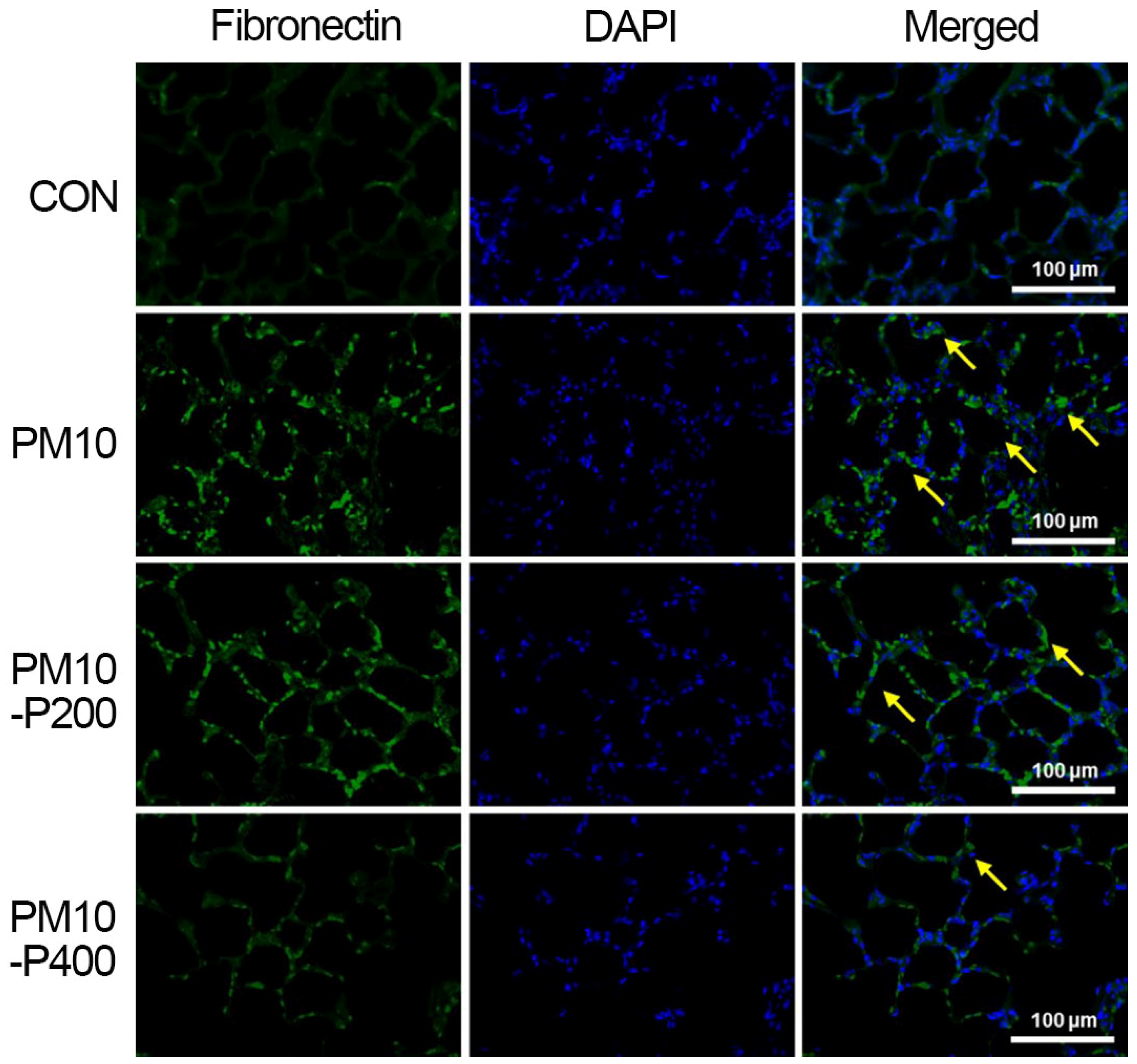 Biomedicines 13 00989 g006