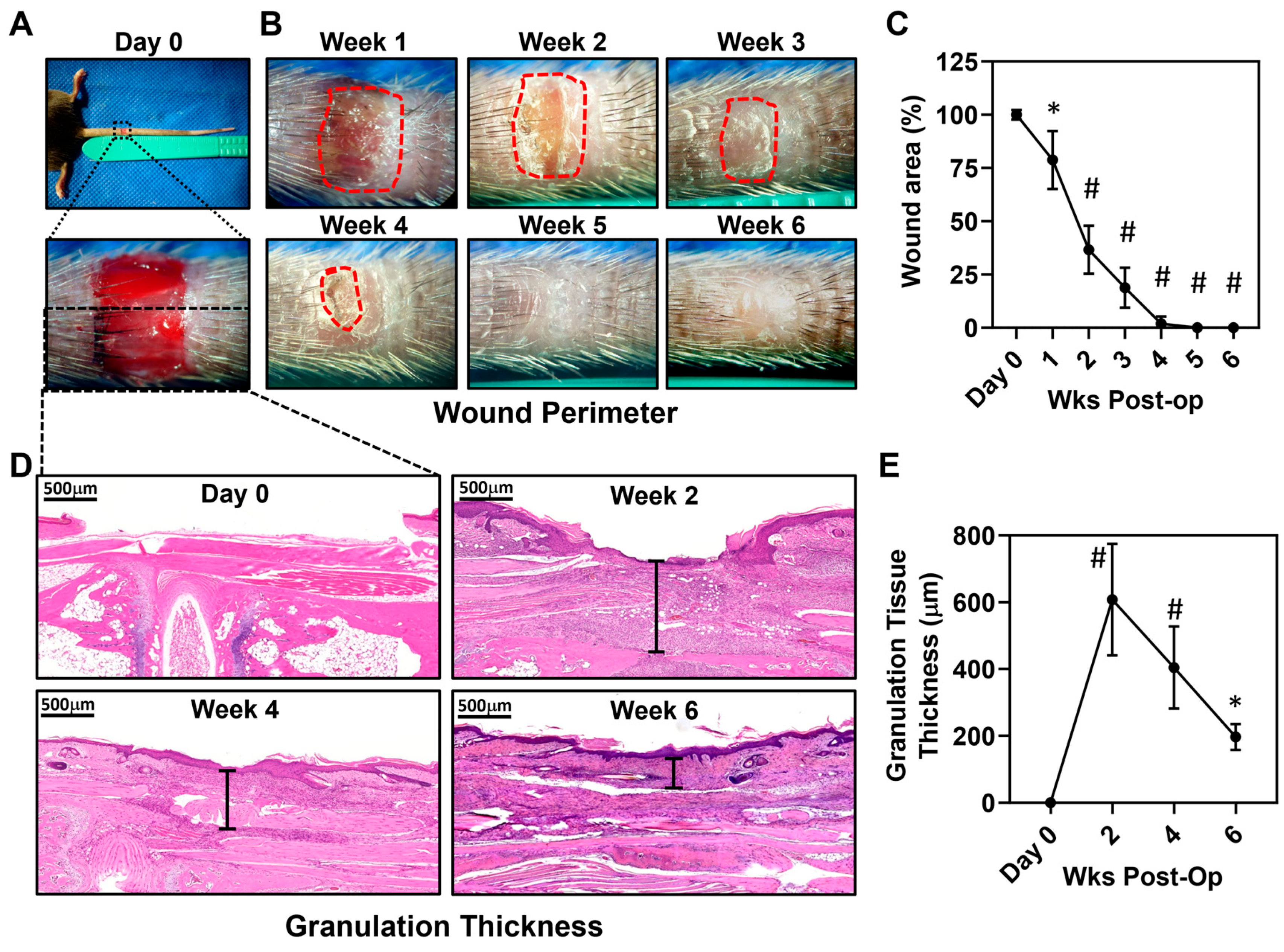 Inhibition of Th2 Differentiation Accelerates Chronic Wound