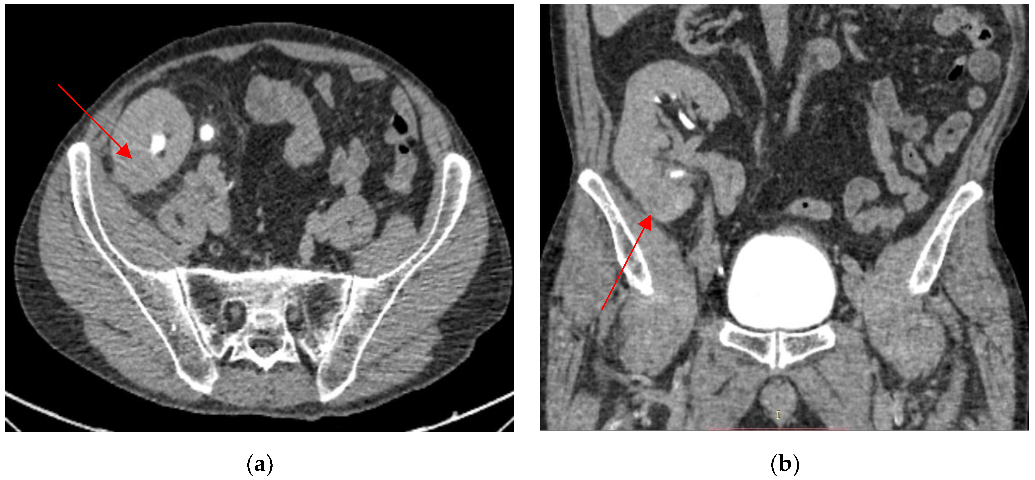 Biomedicines 13 01118 g002 Biomedicines 13 01118 g002