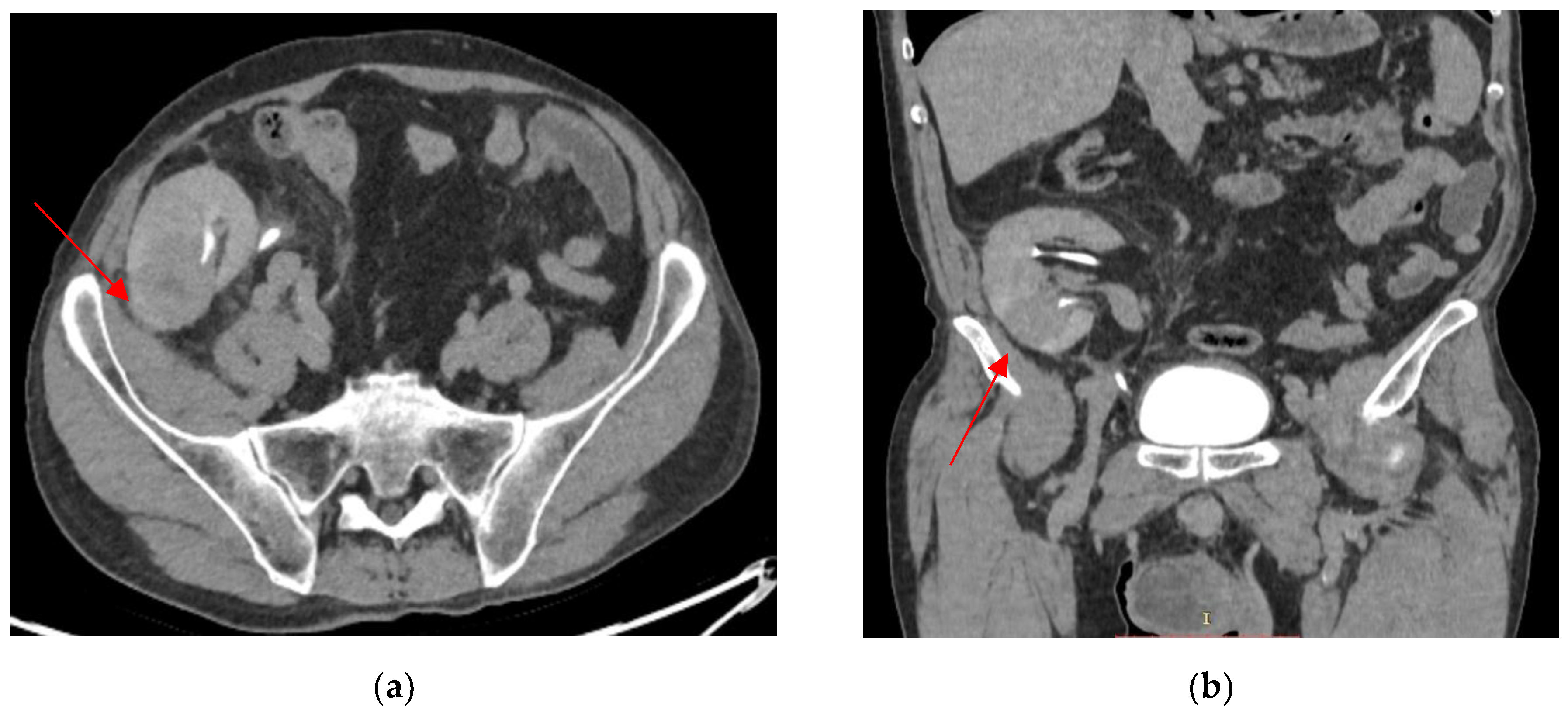 Biomedicines 13 01118 g003 Biomedicines 13 01118 g003