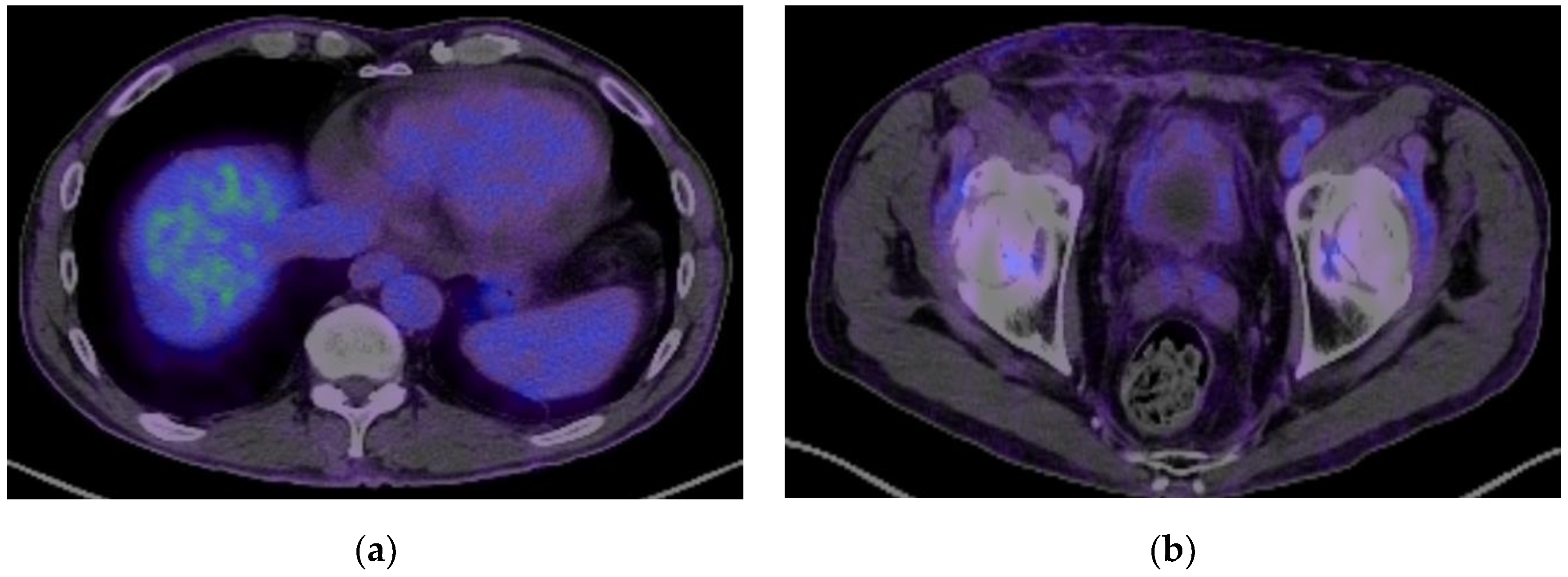 Biomedicines 13 01118 g005 Biomedicines 13 01118 g005