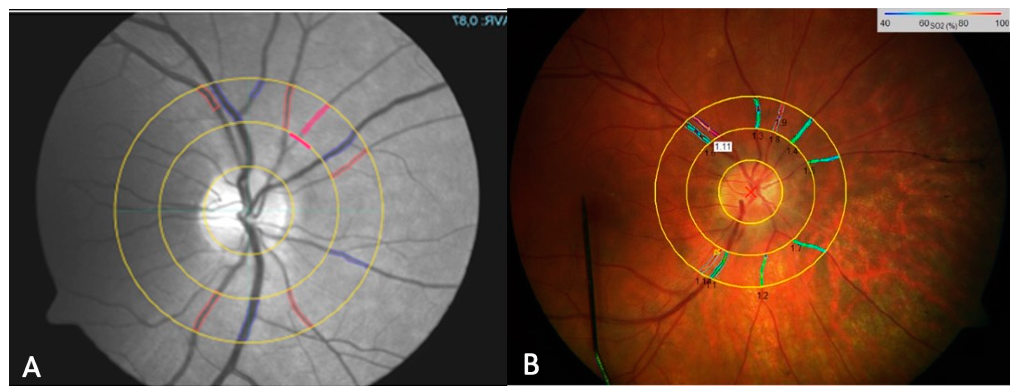 Biomedicines 13 01201 g001 Biomedicines 13 01201 g001