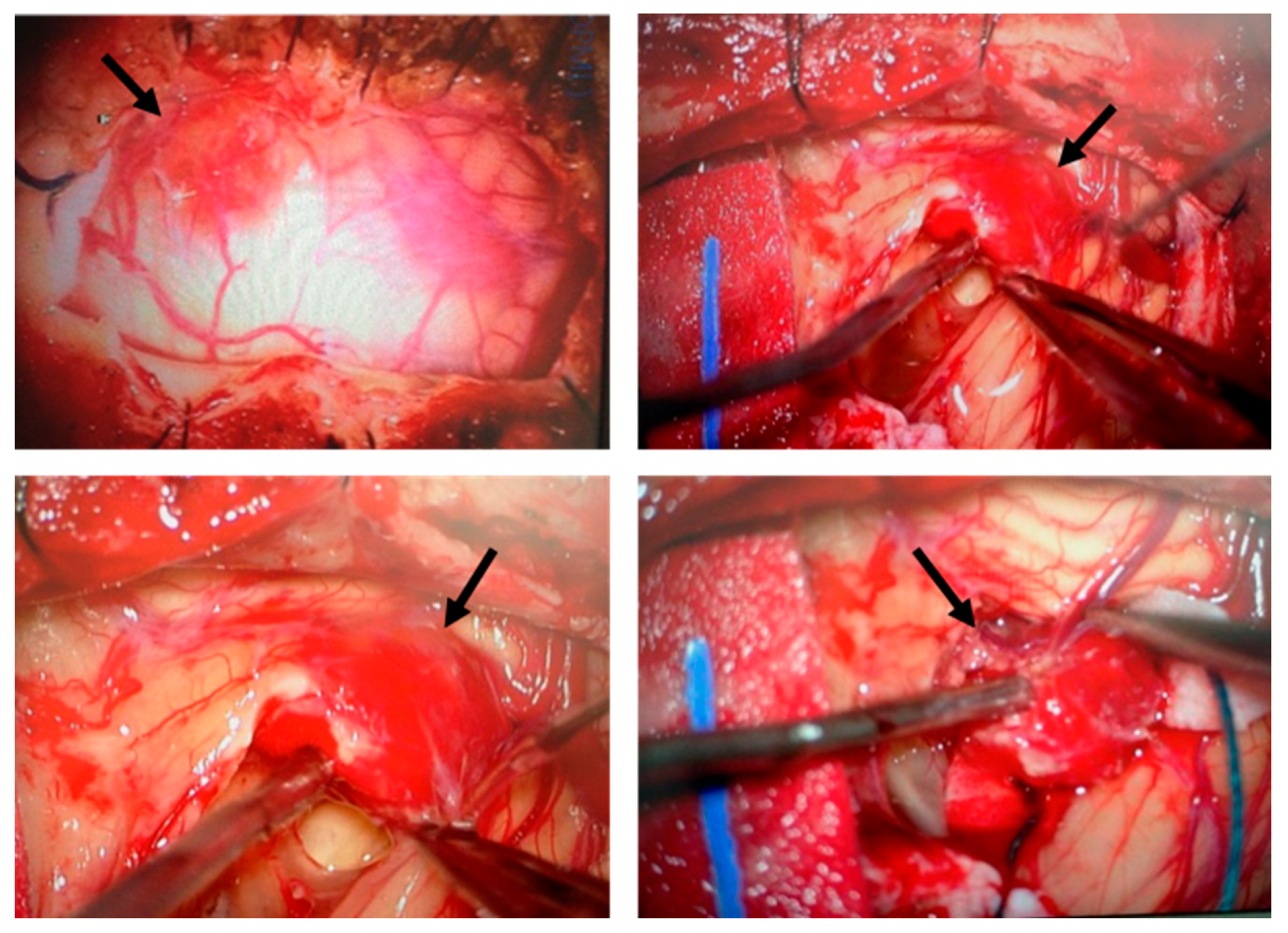Biomedicines 13 01234 g001 Biomedicines 13 01234 g001