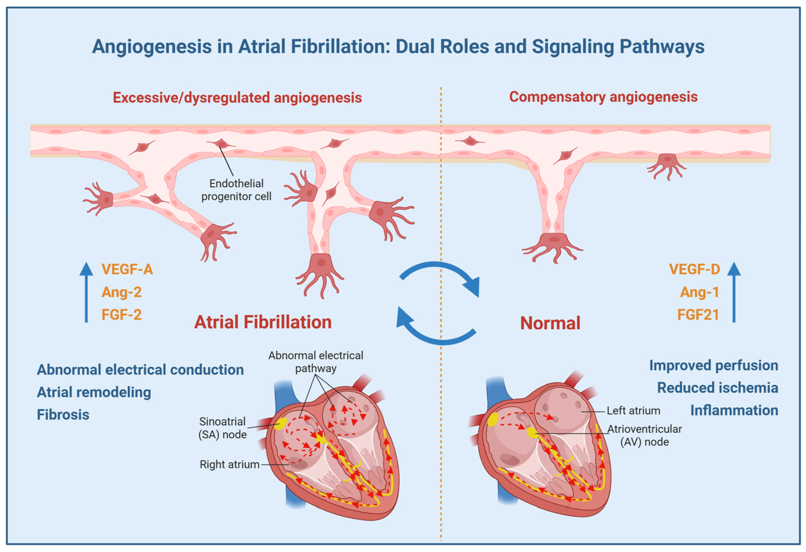 Angiogenesis in Atrial Fibrillation: A Literature Review