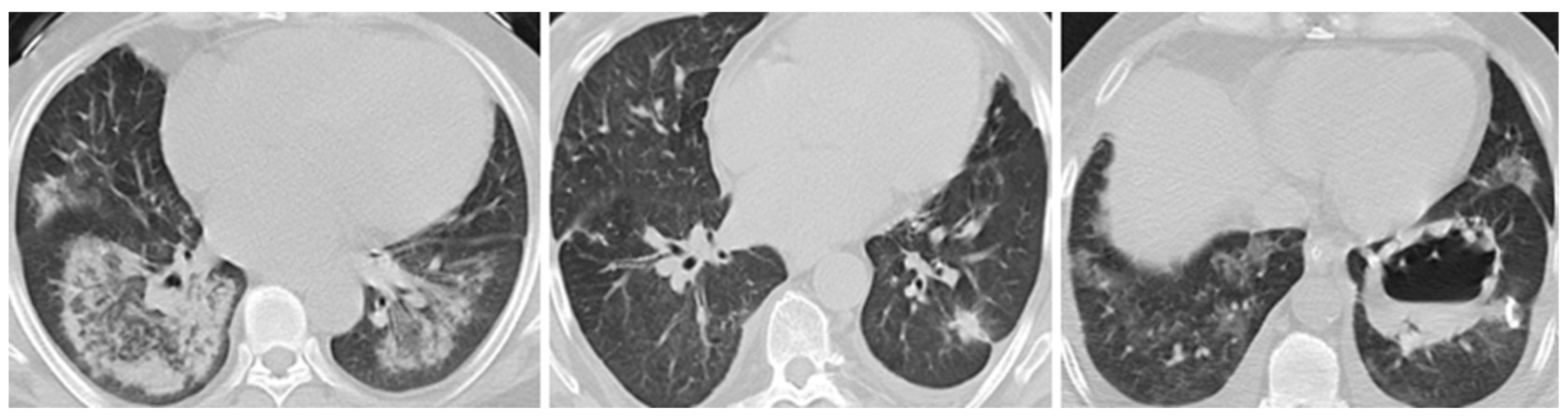 Biomedicines 13 01401 g002 Biomedicines 13 01401 g002