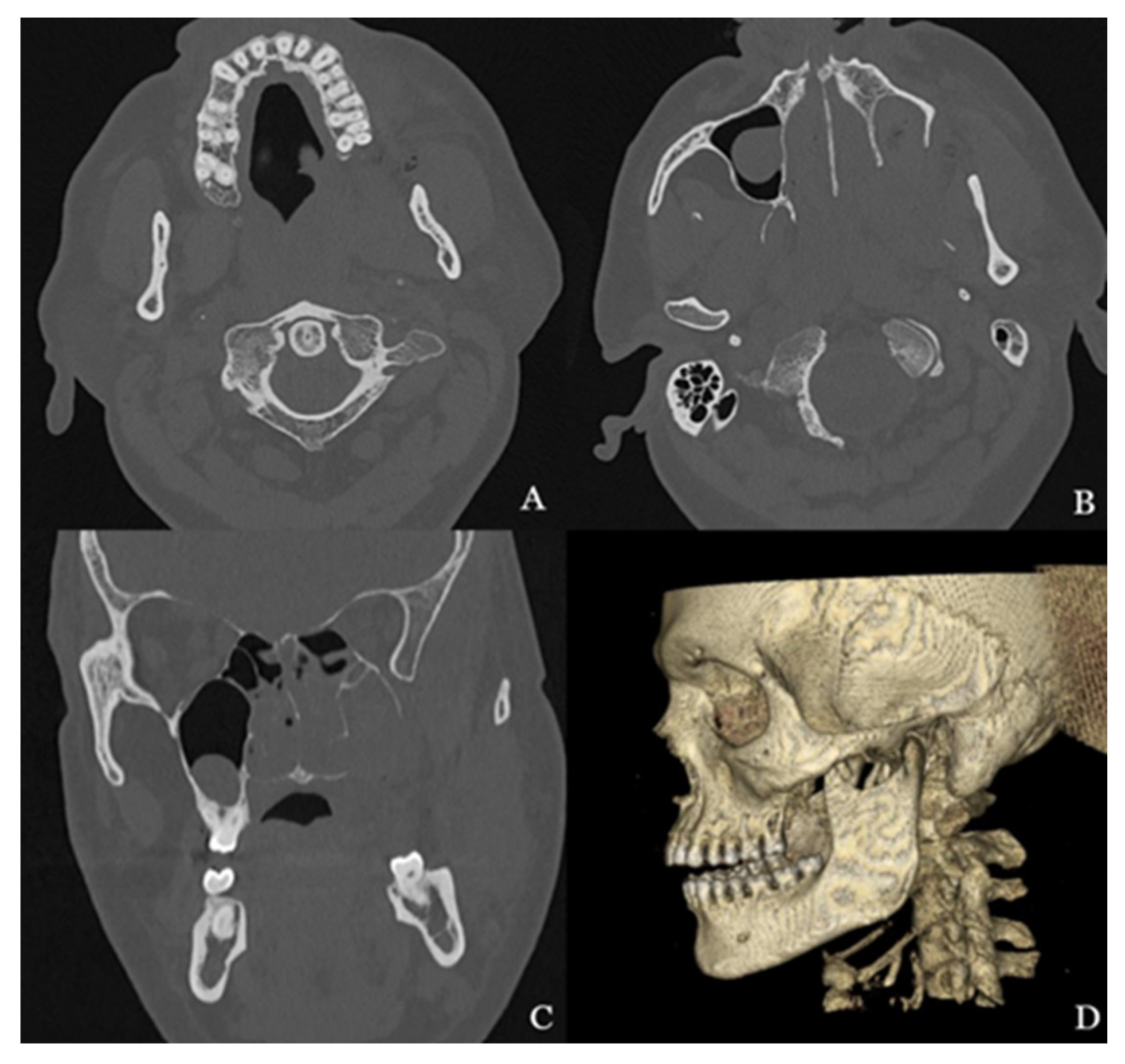 Biomedicines 13 01410 g004 Biomedicines 13 01410 g004