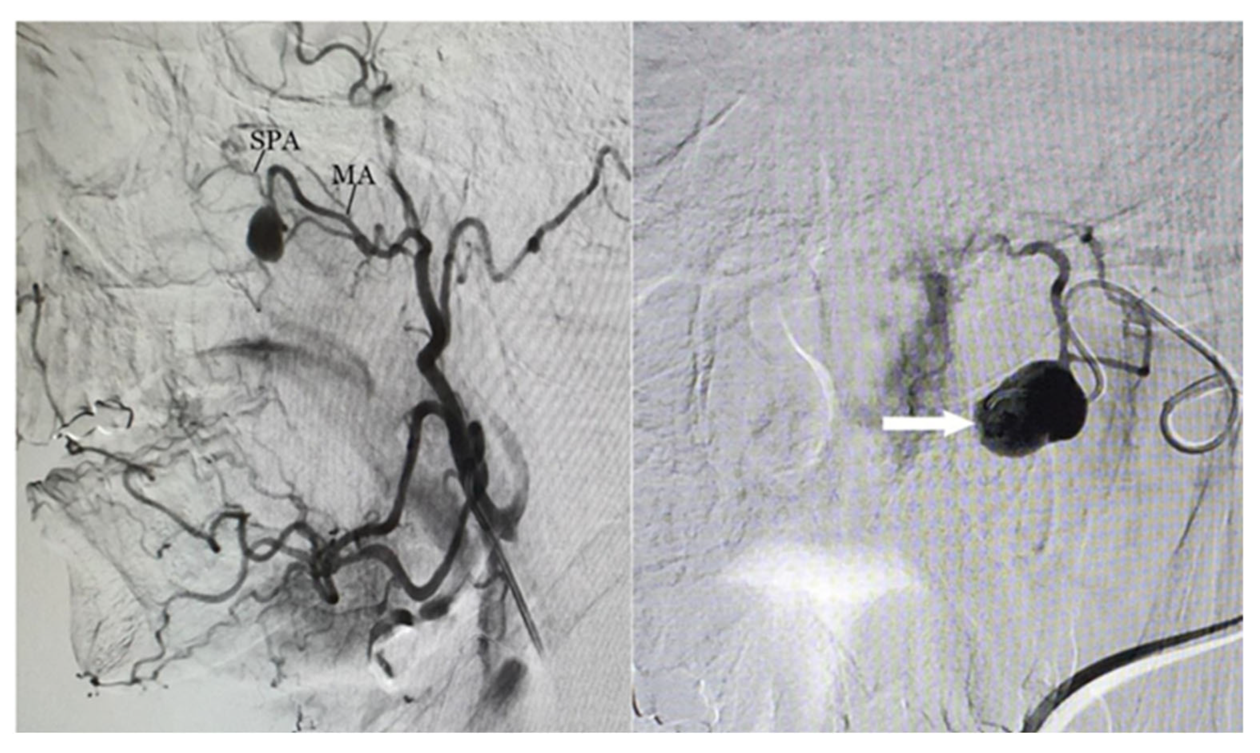 Biomedicines 13 01410 g005 Biomedicines 13 01410 g005