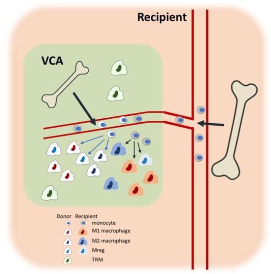 Unraveling the Roles of Macrophages in Vascularized Composite