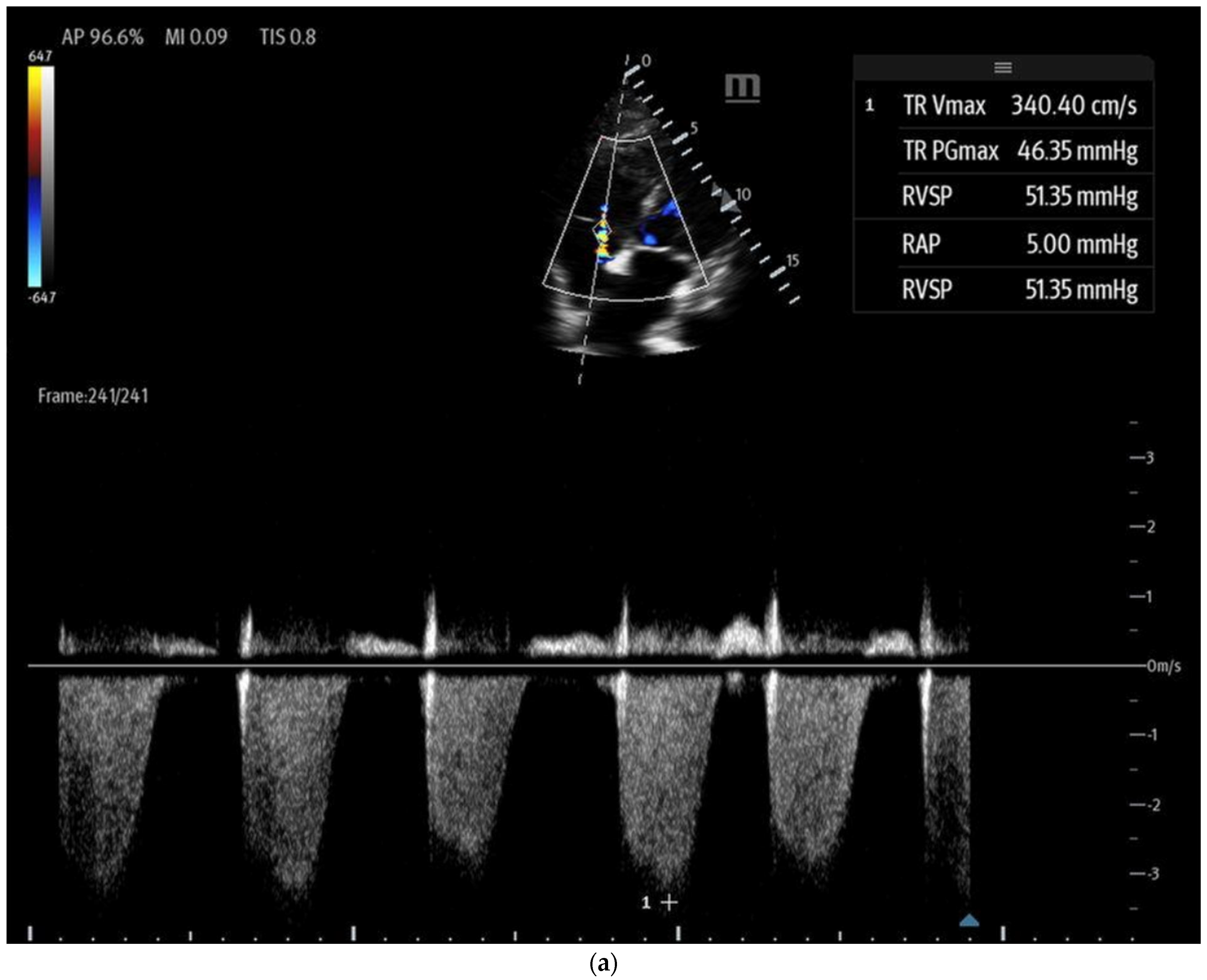 Biomedicines 13 01426 g008a