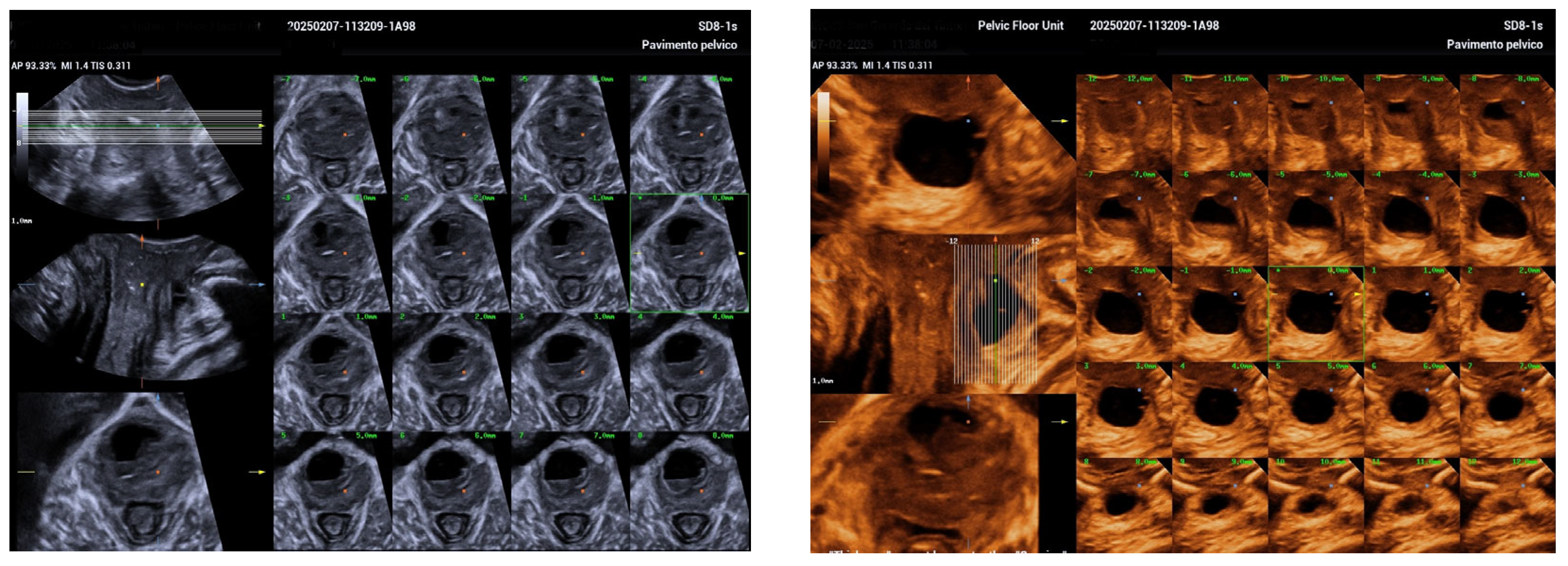 Biomedicines 13 01432 g004 Biomedicines 13 01432 g004