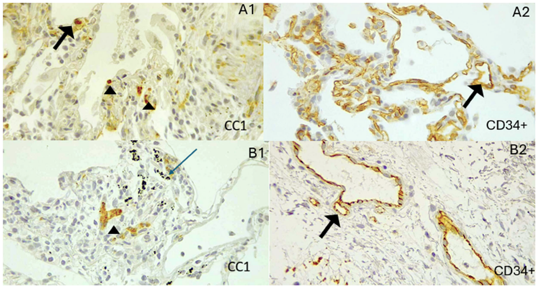 Biomedicines 13 01593 g002 Biomedicines 13 01593 g002