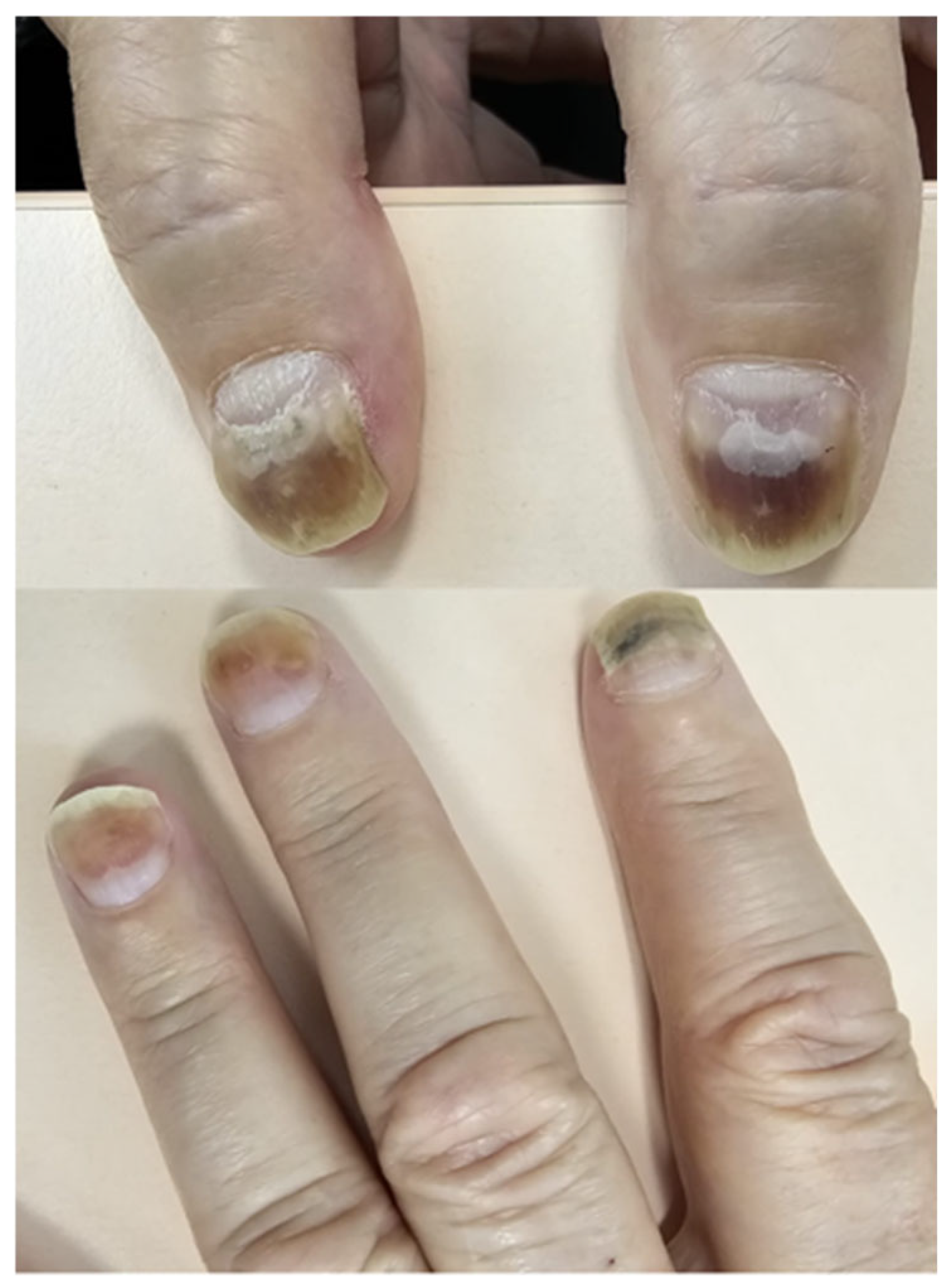 Biomedicines 13 01901 g003 Biomedicines 13 01901 g003