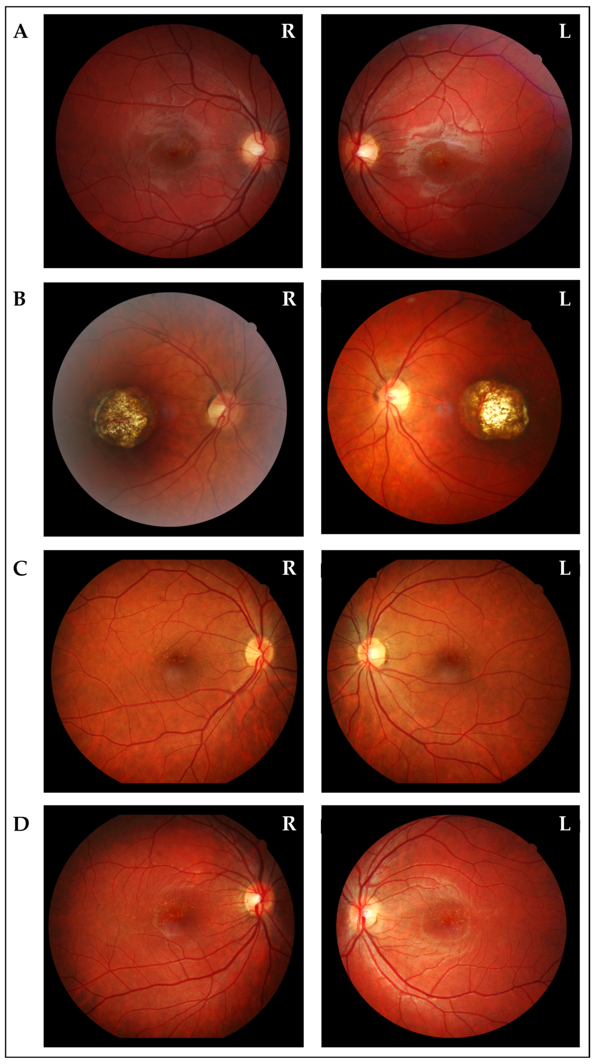 Biomedicines 13 01904 g003 Biomedicines 13 01904 g003