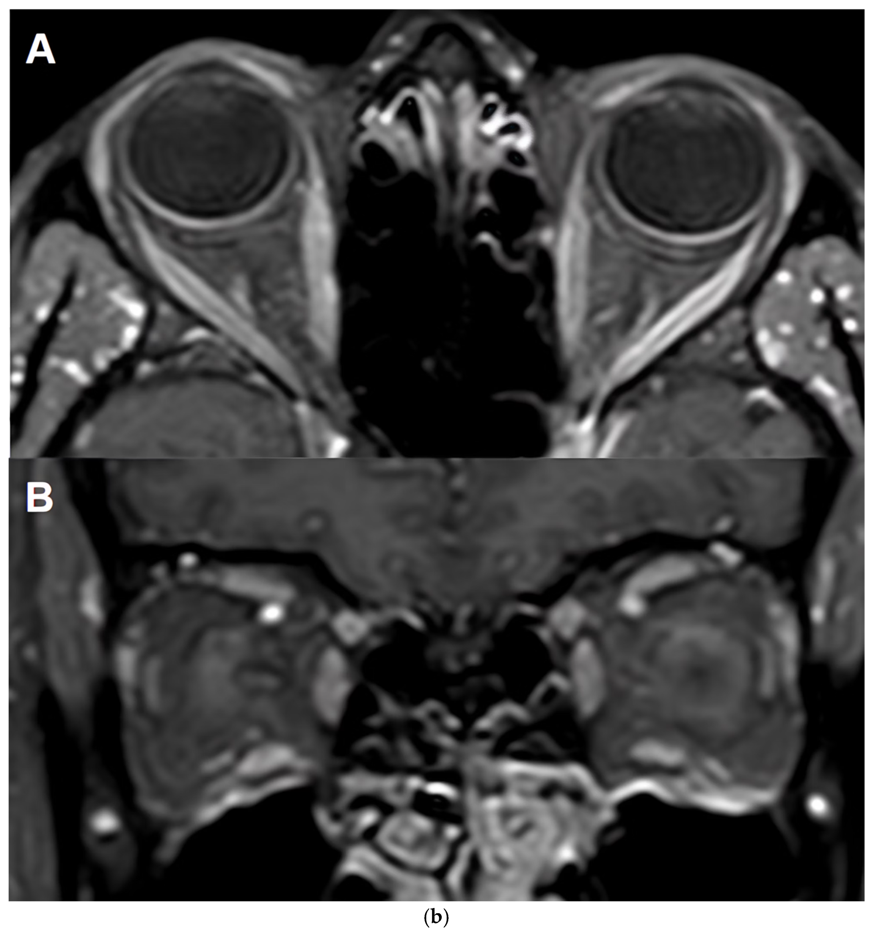 Biomedicines 13 02344 g001b