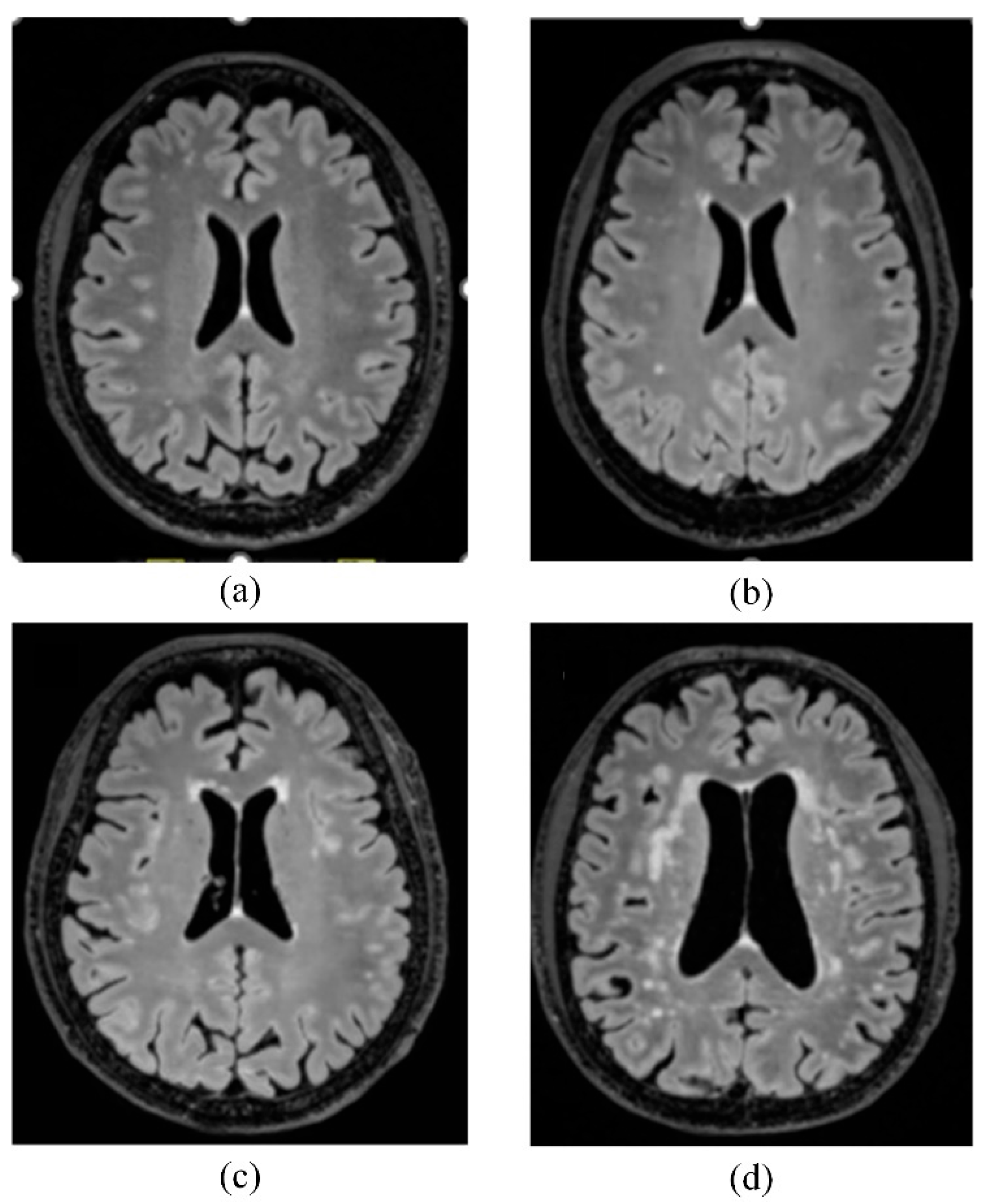 Biomedicines 13 02553 g002 Biomedicines 13 02553 g002