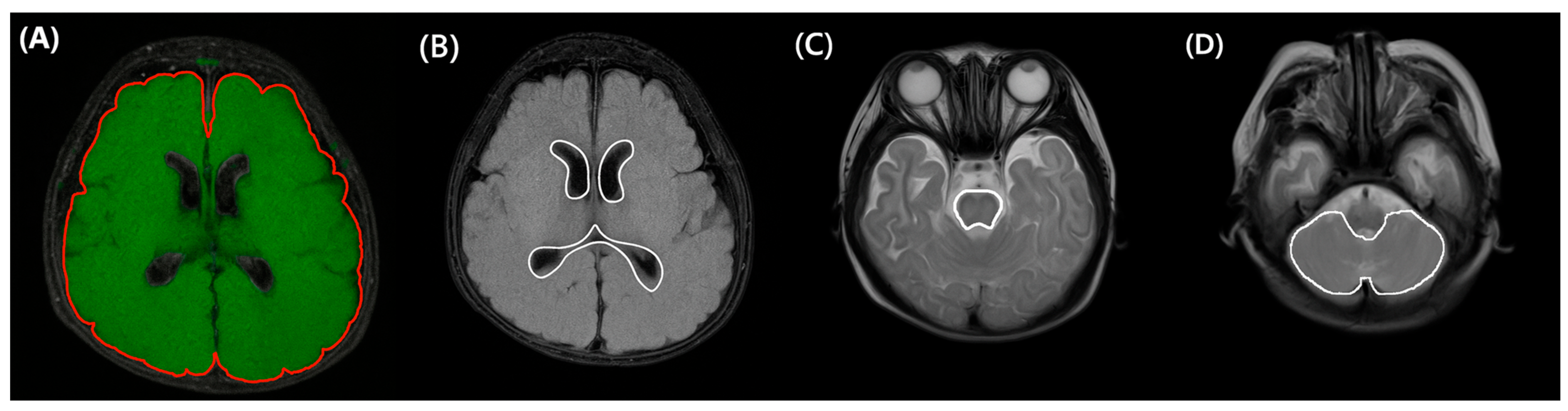 Biomedicines 13 02765 g002 Biomedicines 13 02765 g002