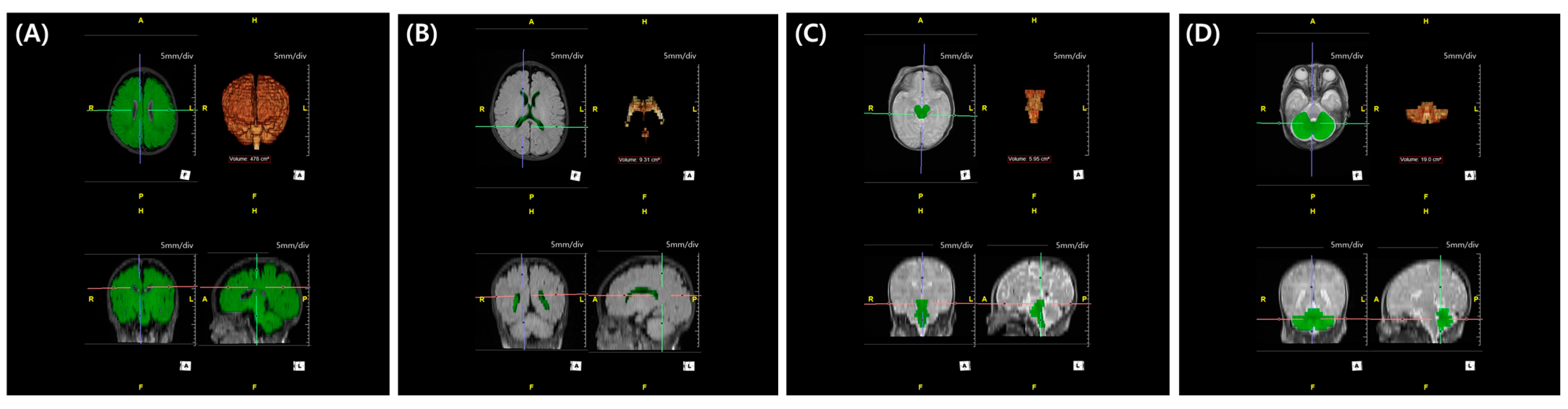 Biomedicines 13 02765 g003 Biomedicines 13 02765 g003