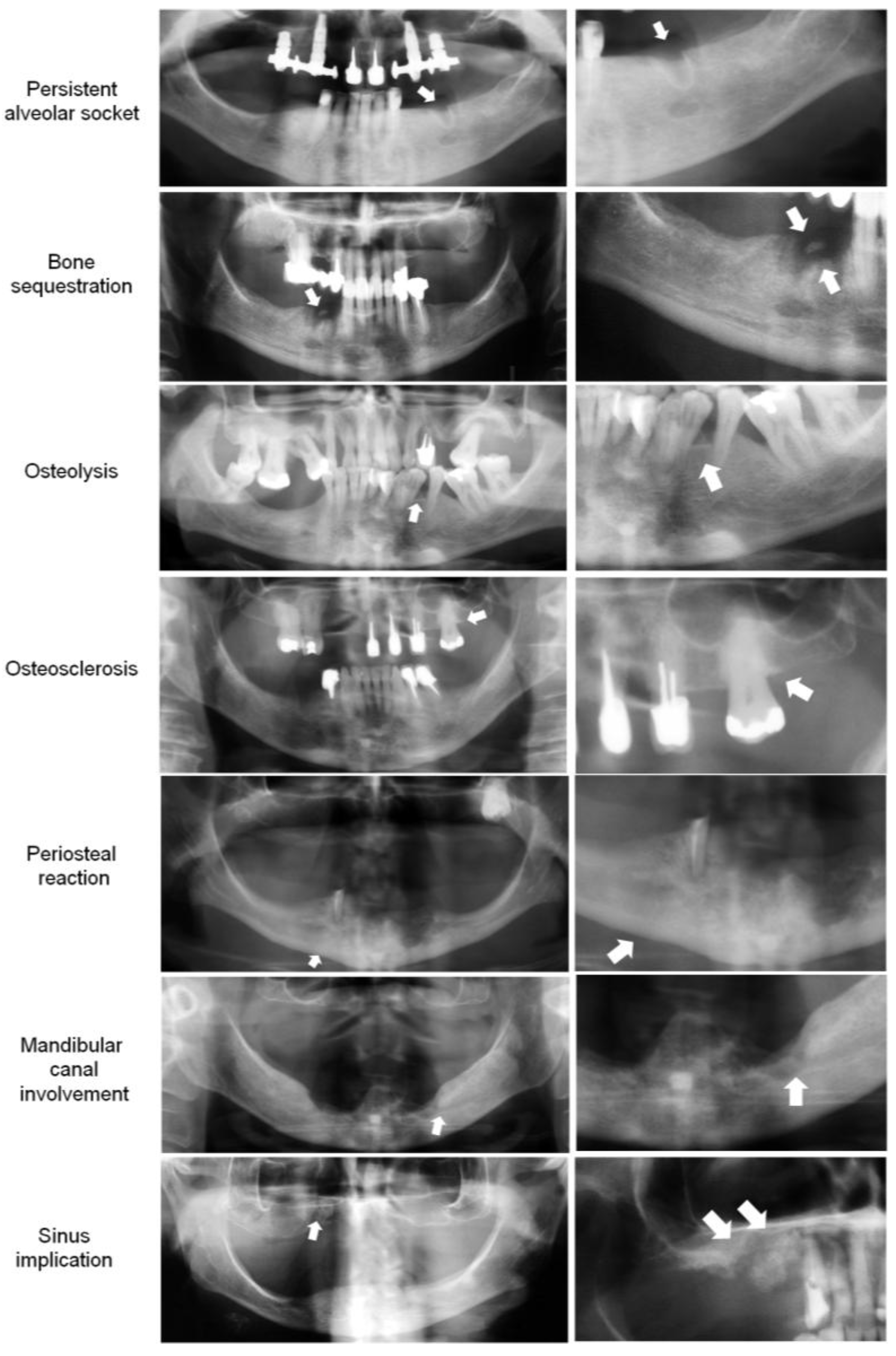Biomedicines 13 03054 g008 Biomedicines 13 03054 g008