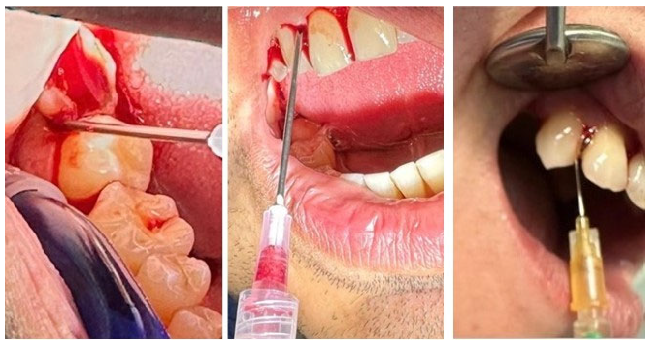 Biomedicines 14 00135 g004 Biomedicines 14 00135 g004