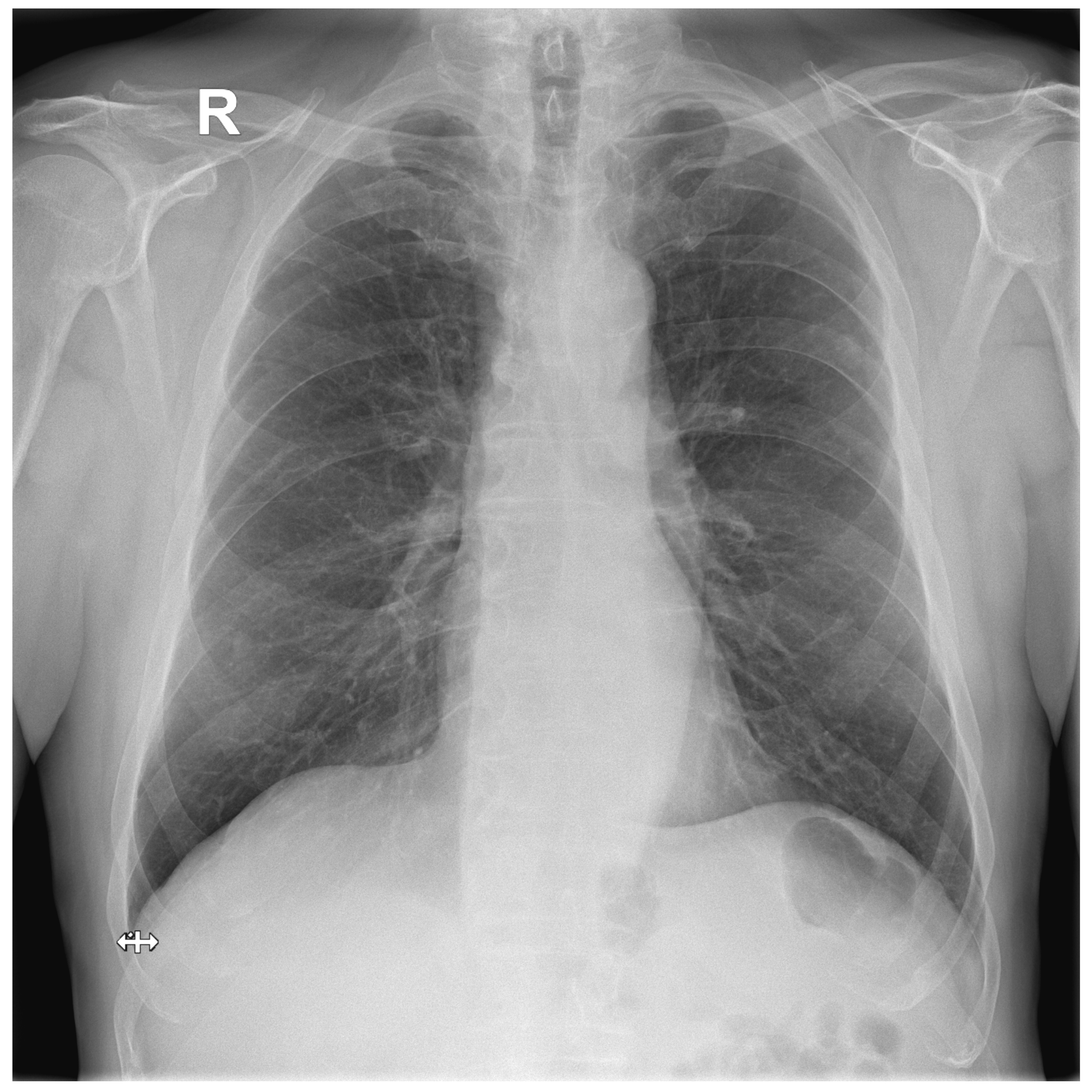 Biomedinformatics 03 00006 g0a3
