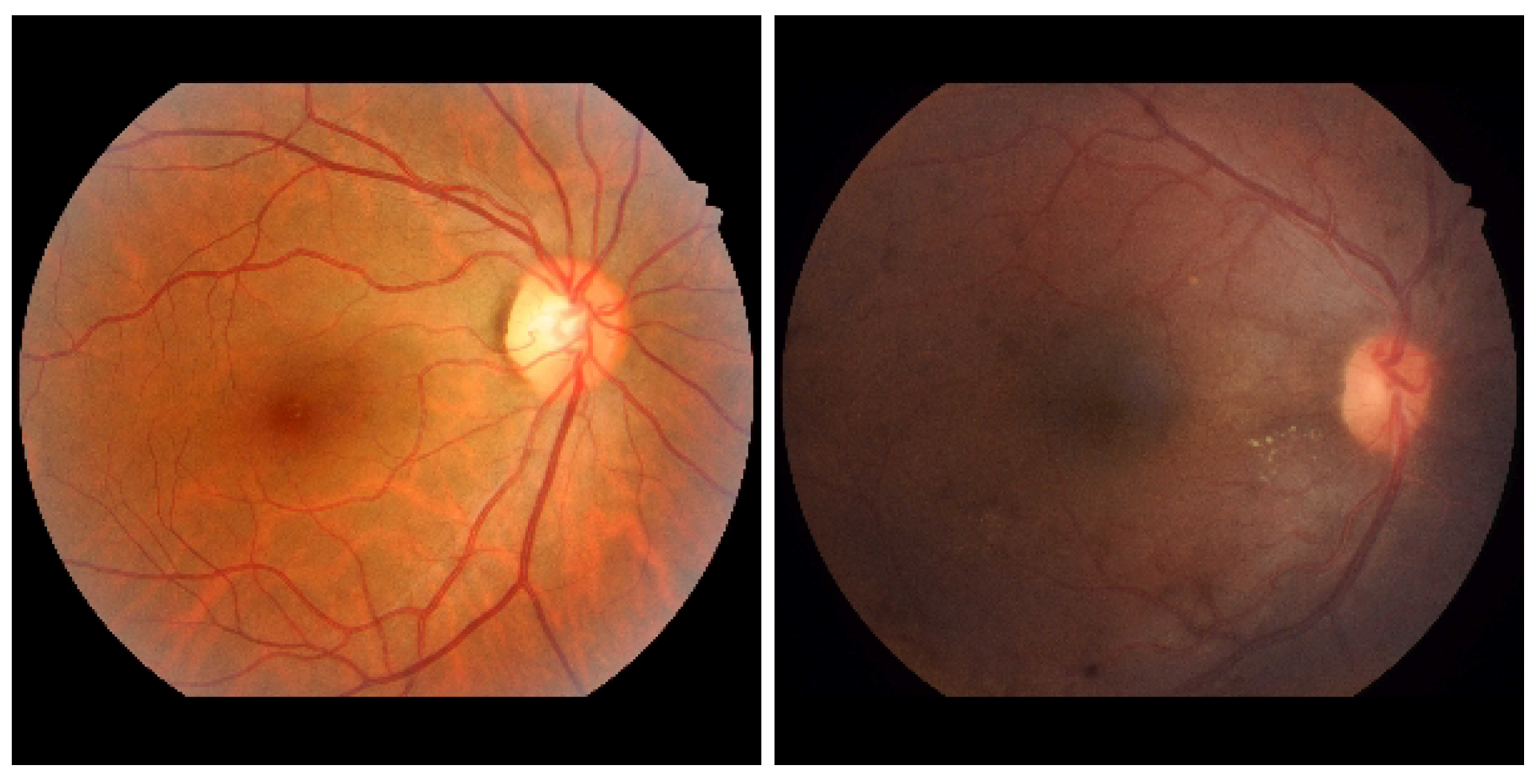Biomedinformatics 03 00058 g004