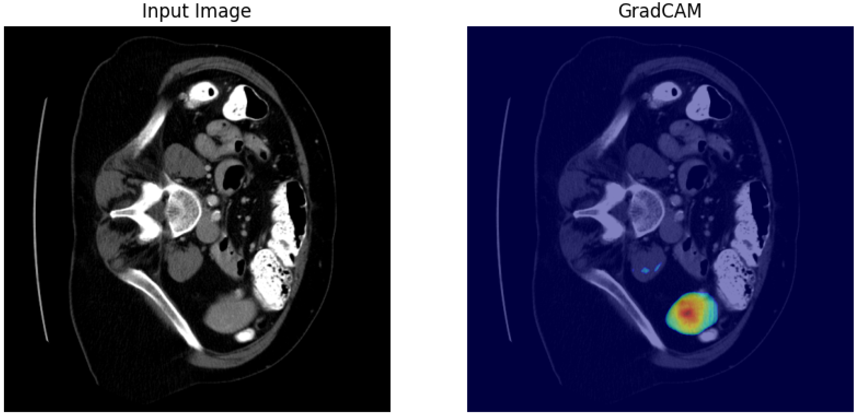 Biomedinformatics 05 00056 g009 Biomedinformatics 05 00056 g009