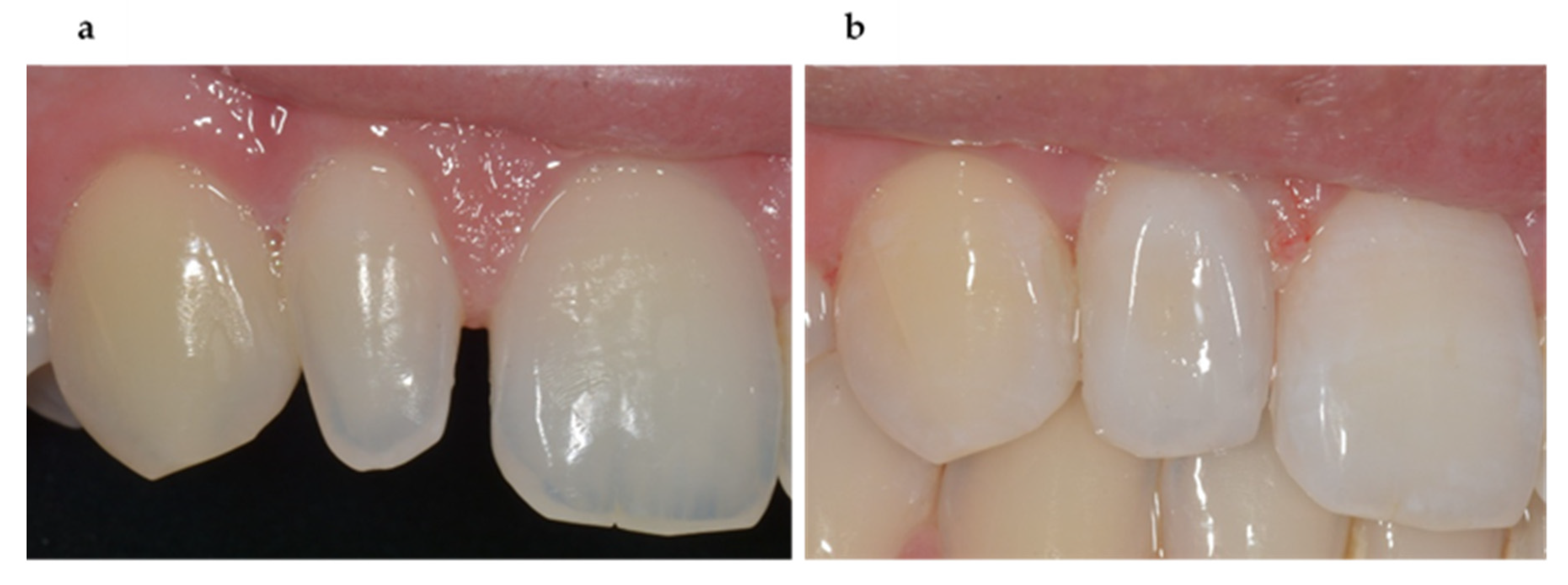 Biomimetics Free Full Text Biomimetic Aspects Of Restorative Dentistry Biomaterials Html Biomimetics Free Full Text Biomimetic Aspects Of Restorative Dentistry Biomaterials Html