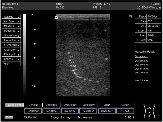 Biomimetics 07 00130 i005