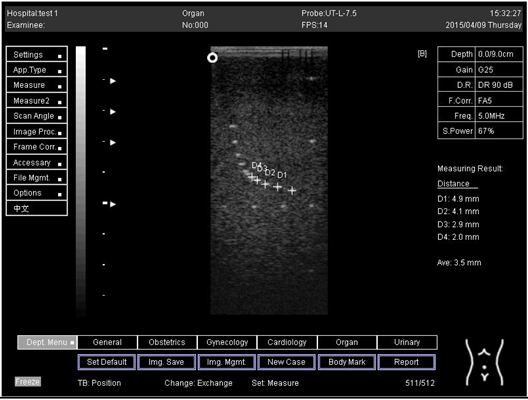 Biomimetics 07 00130 i010