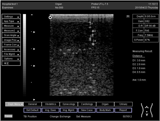 Biomimetics 07 00130 i011