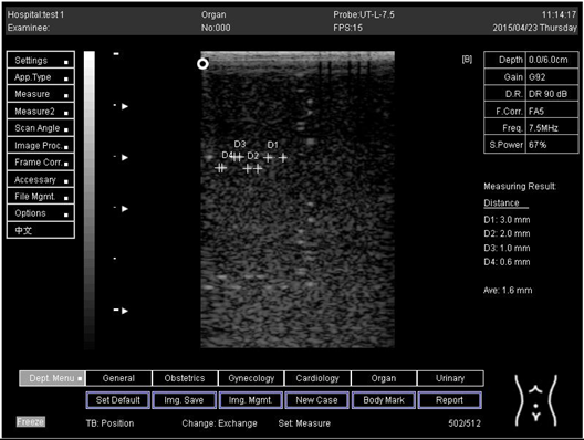 Biomimetics 07 00130 i014